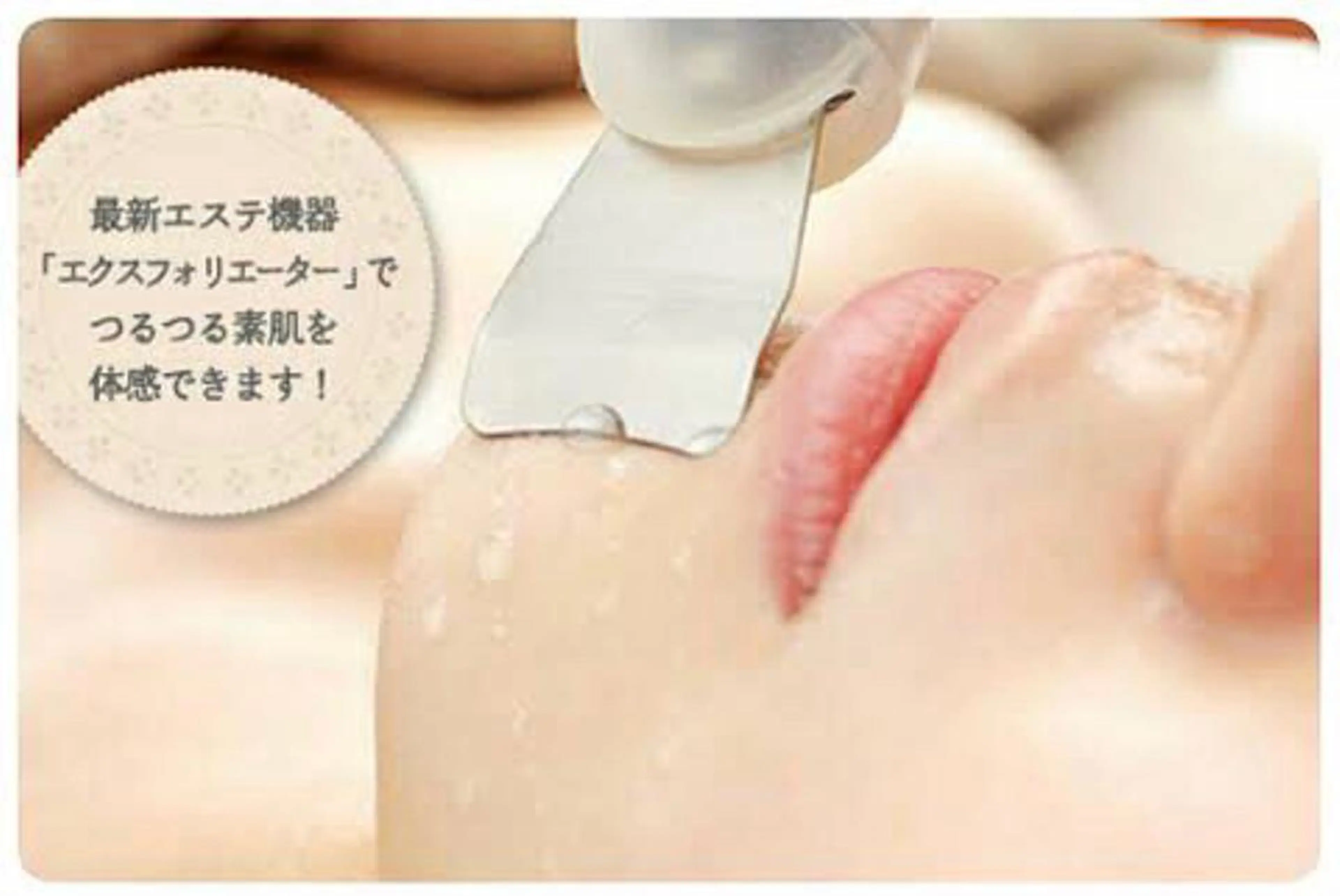 エクスフォリエーターの写真