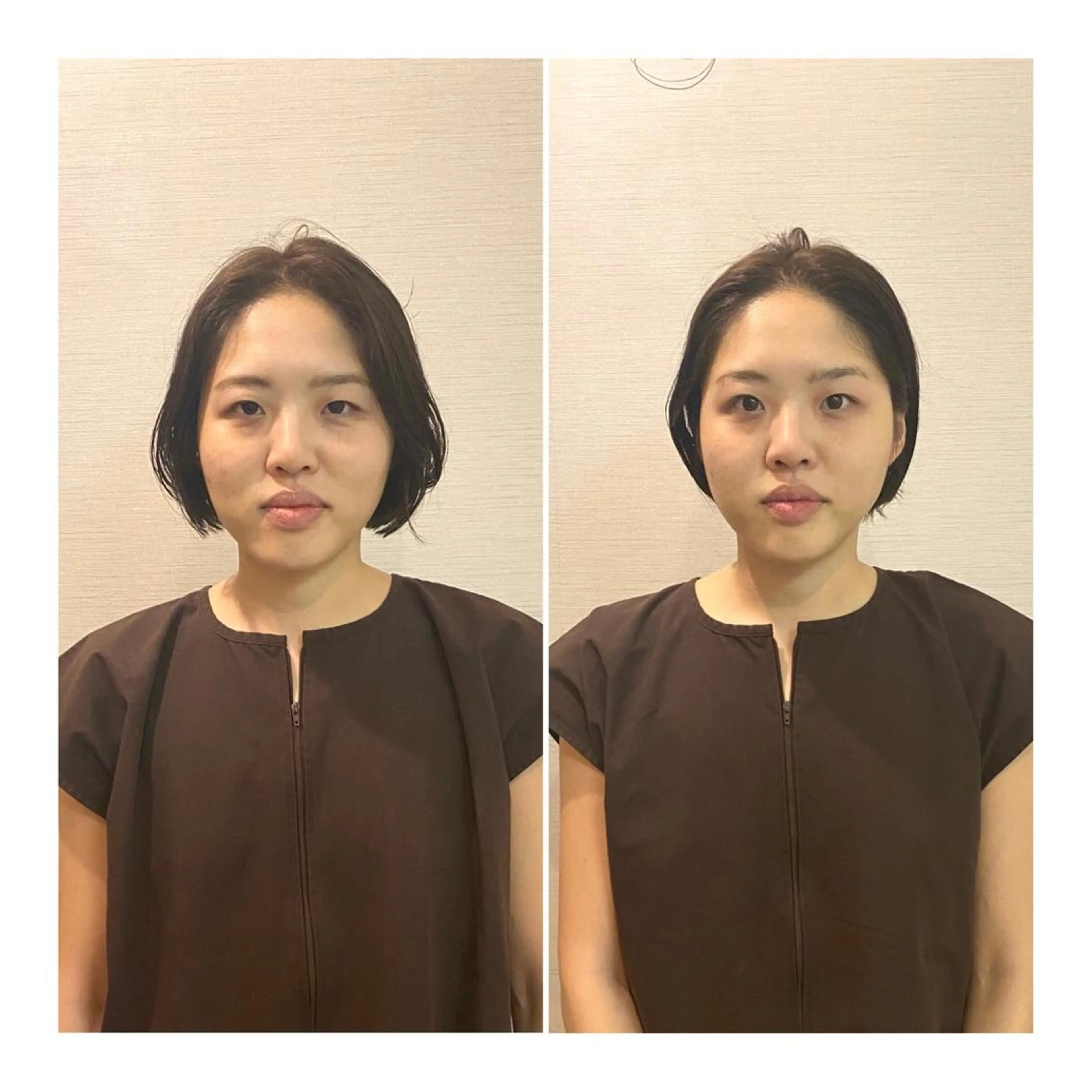 即小顔♥️美容鍼× ハーブピーリングのその他イメージ