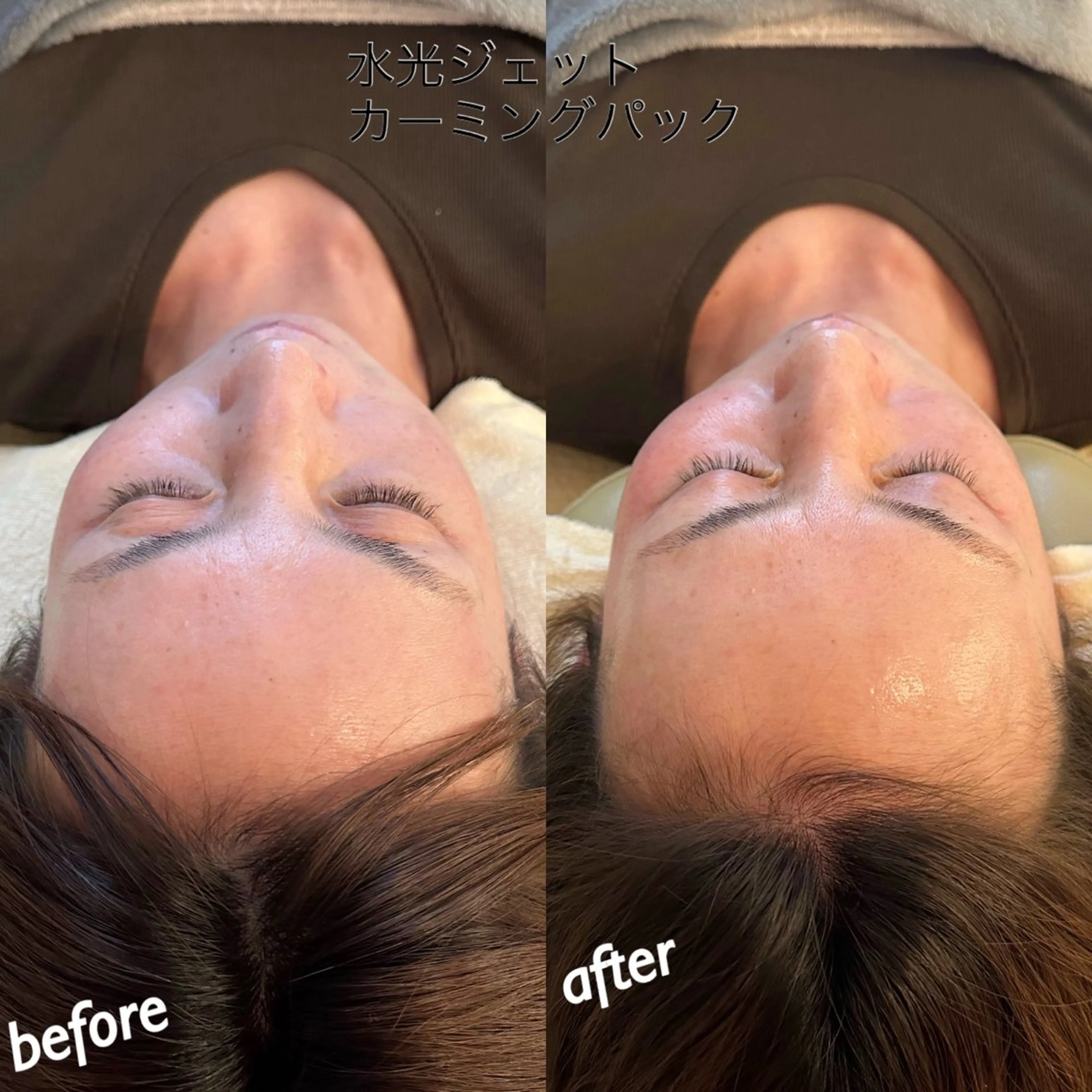 エステ うなじ脱毛/美肌脱毛 LABELのエステ・リラクイメージ