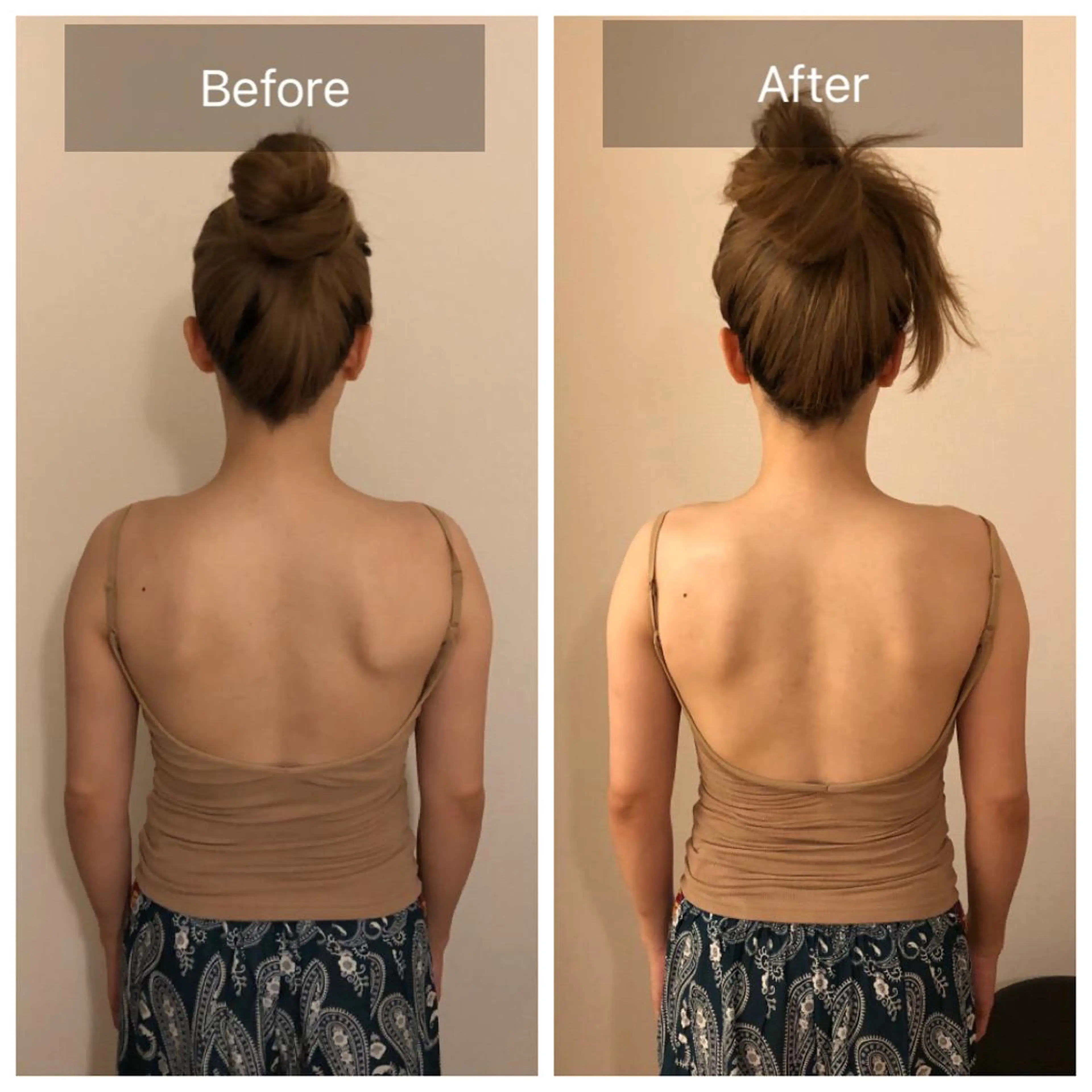 首肩背中ウエストスッキリ！【仰向け美背中トリートメント60分】の写真