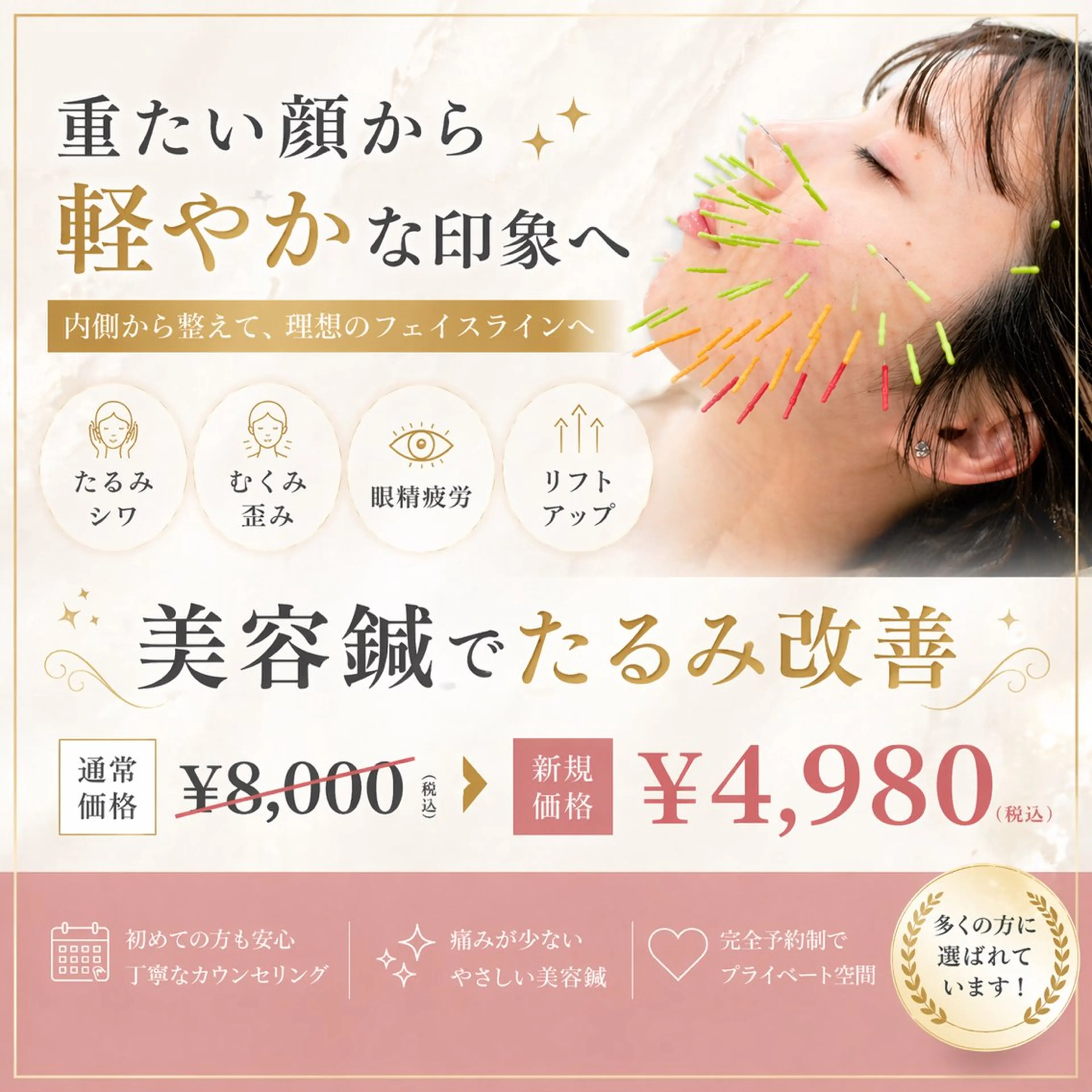 【人気No.1メニュー】美容鍼(たるみ 小顔 ほうれい線 眼精疲労 顔のむくみ リフトアップ たるみ)(60分)の写真