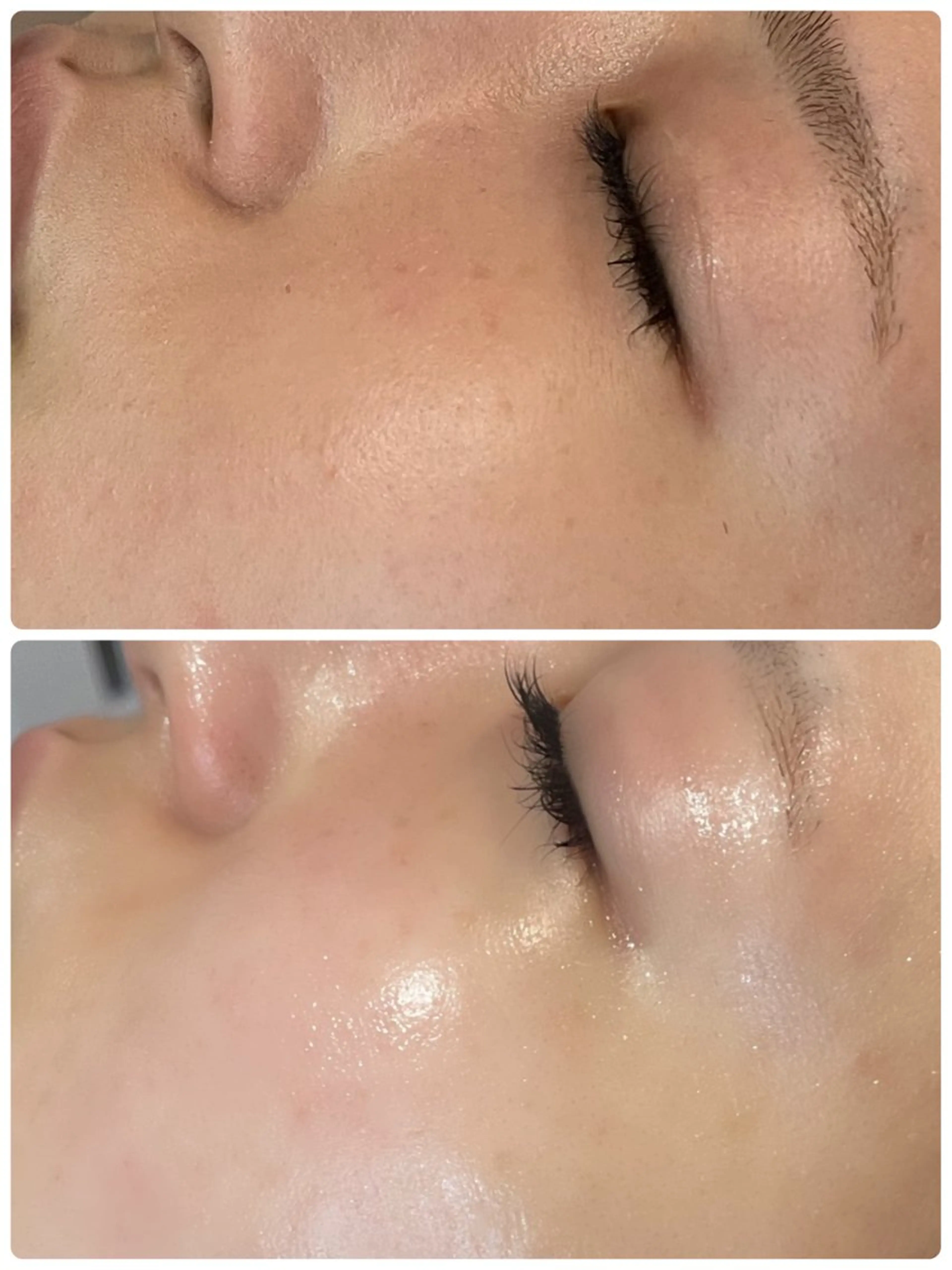 毛穴レスプレミアムエステの写真