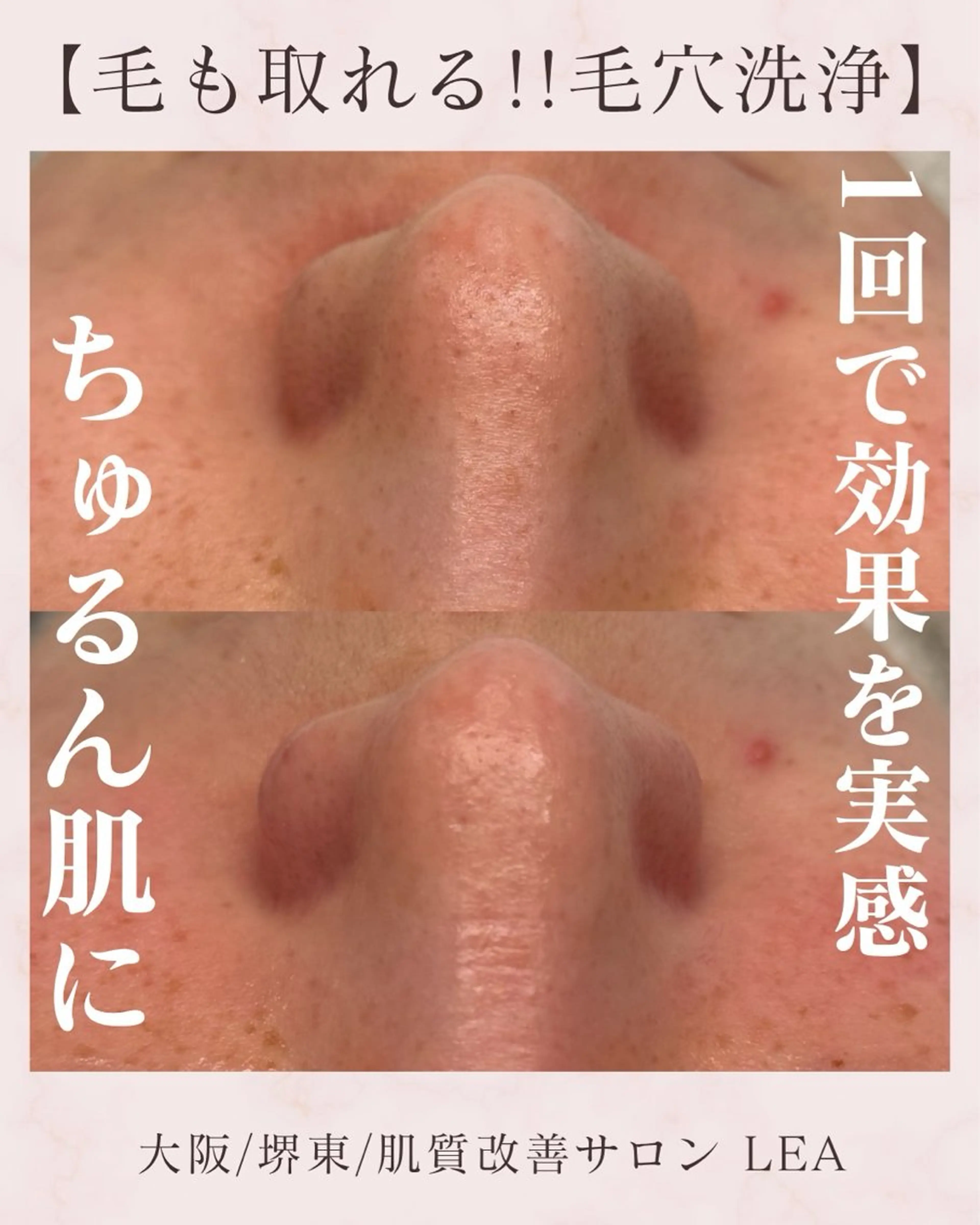 エステ Lea堺東　毛穴洗浄 ×顔ワックス脱毛のその他イメージ