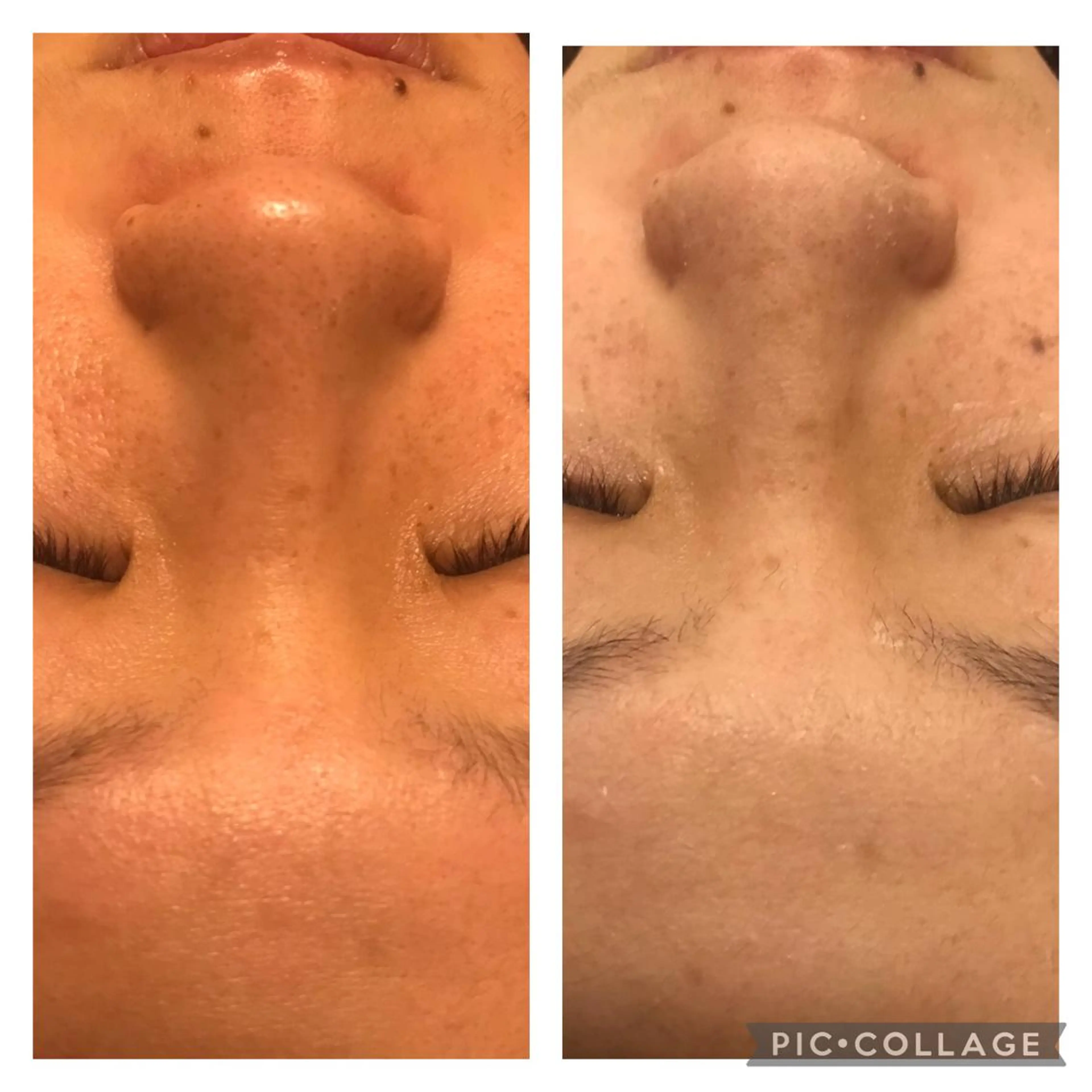 ミディアム カラー パーマ ヘアアレンジ メンズ キッズ ネイル マツエク・マツパ アニメ,Vオタク× 即効痩せエステサロンのエステ・リラクイメージ