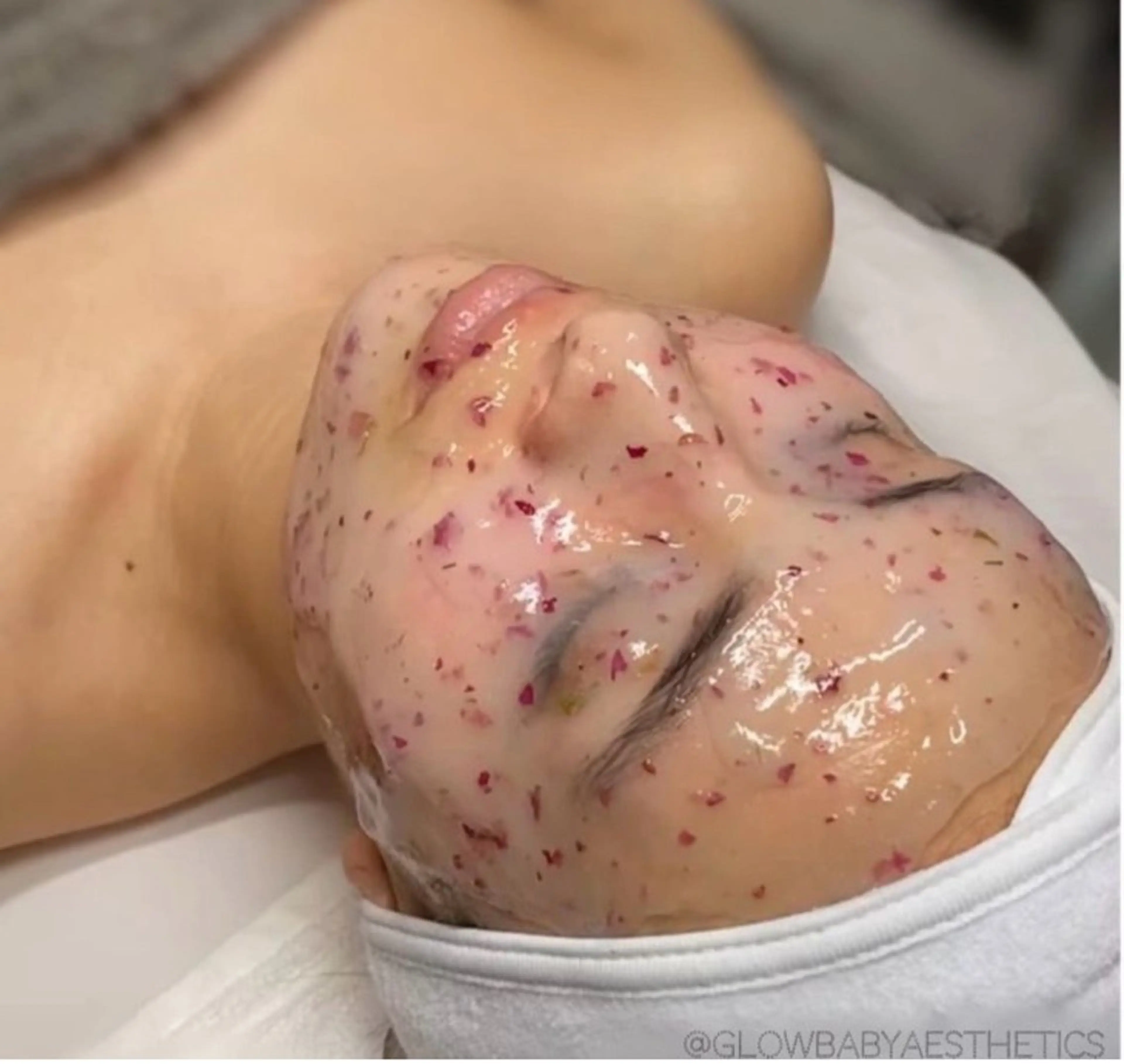 池袋美容鍼サロン ヴィクトワール　小林のエステ・リラクイメージ