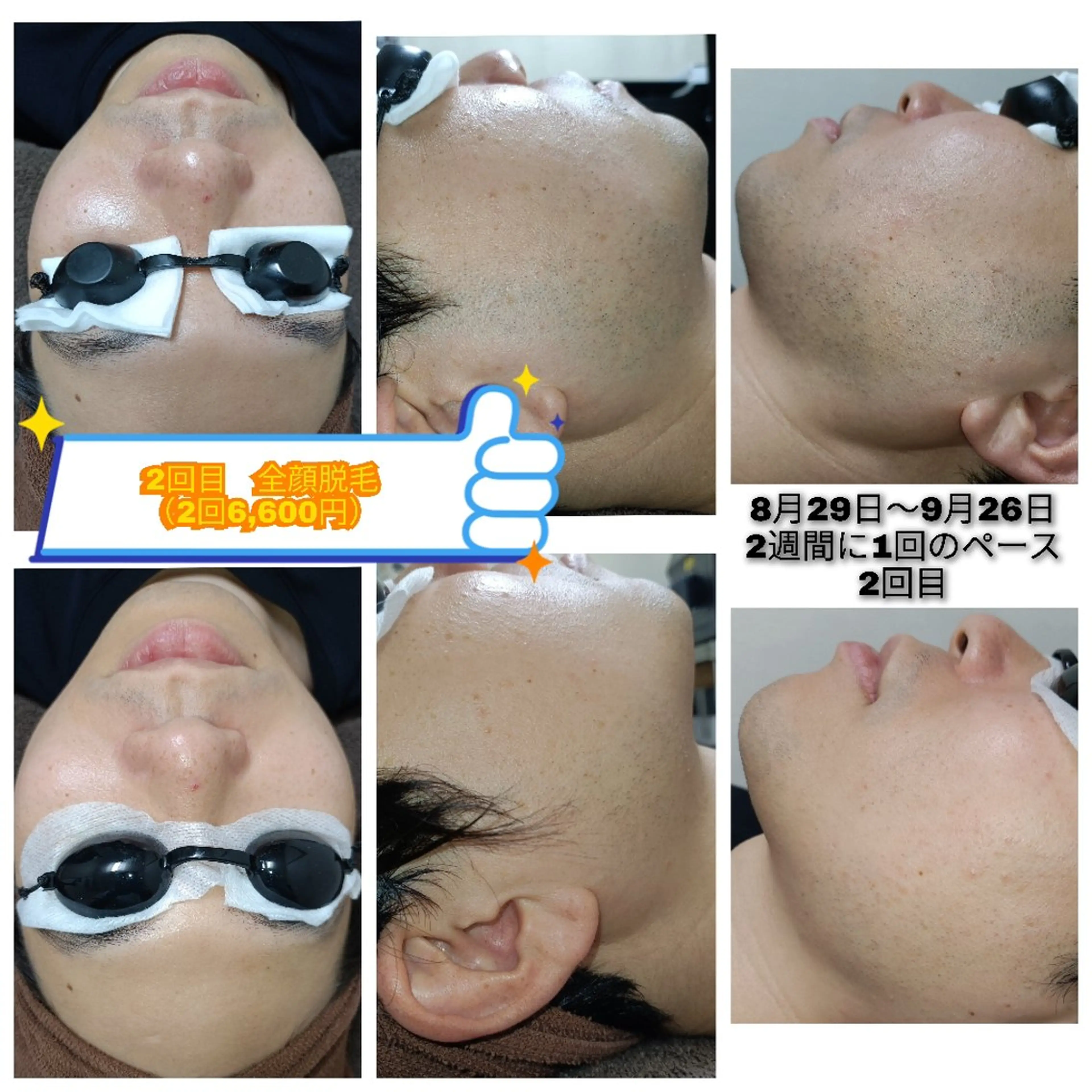 メンズ 脱毛 武 藤のエステ・リラクイメージ