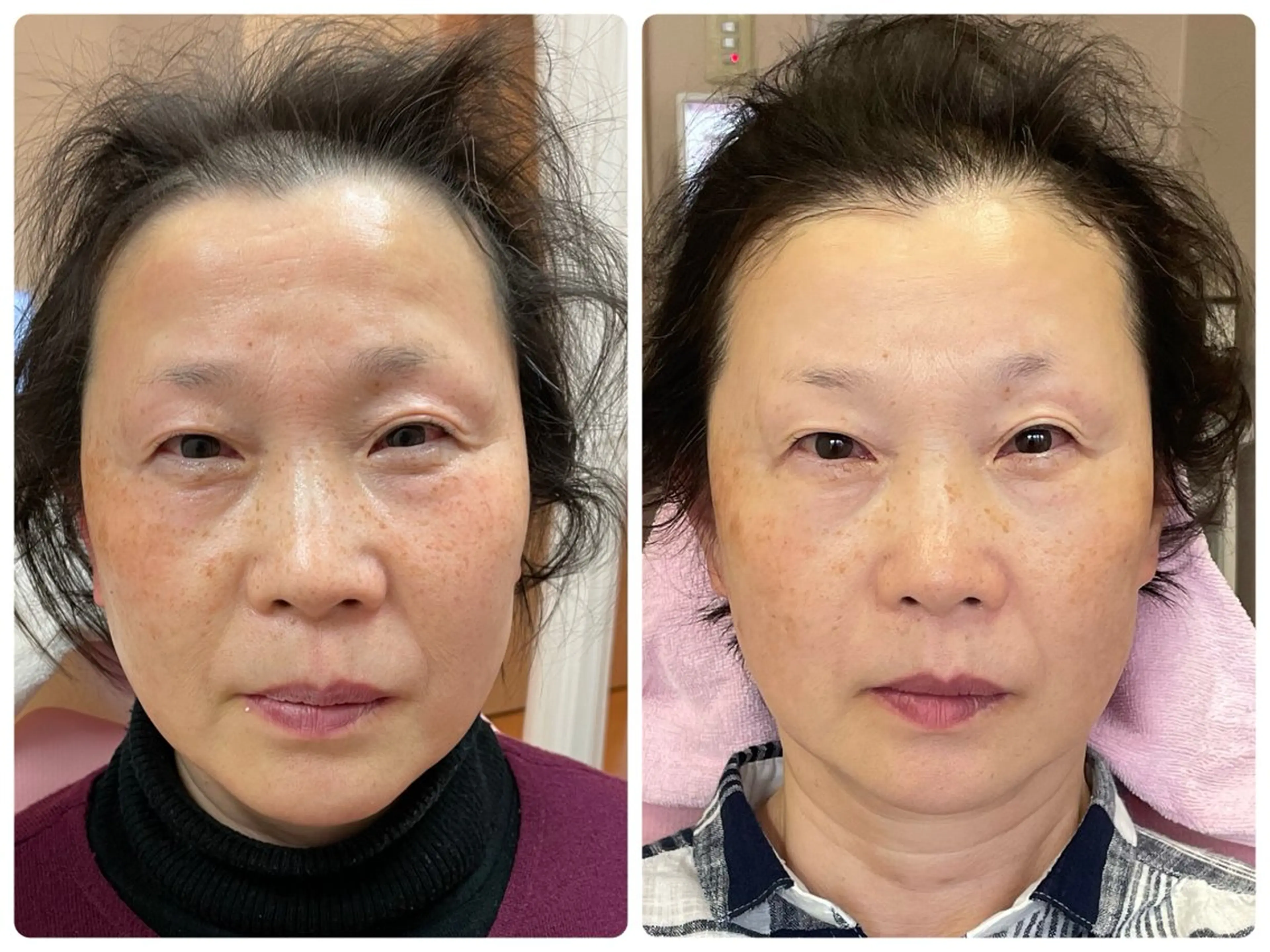 Salon Rion所属・Rion 野々村のエステ・リラクイメージ