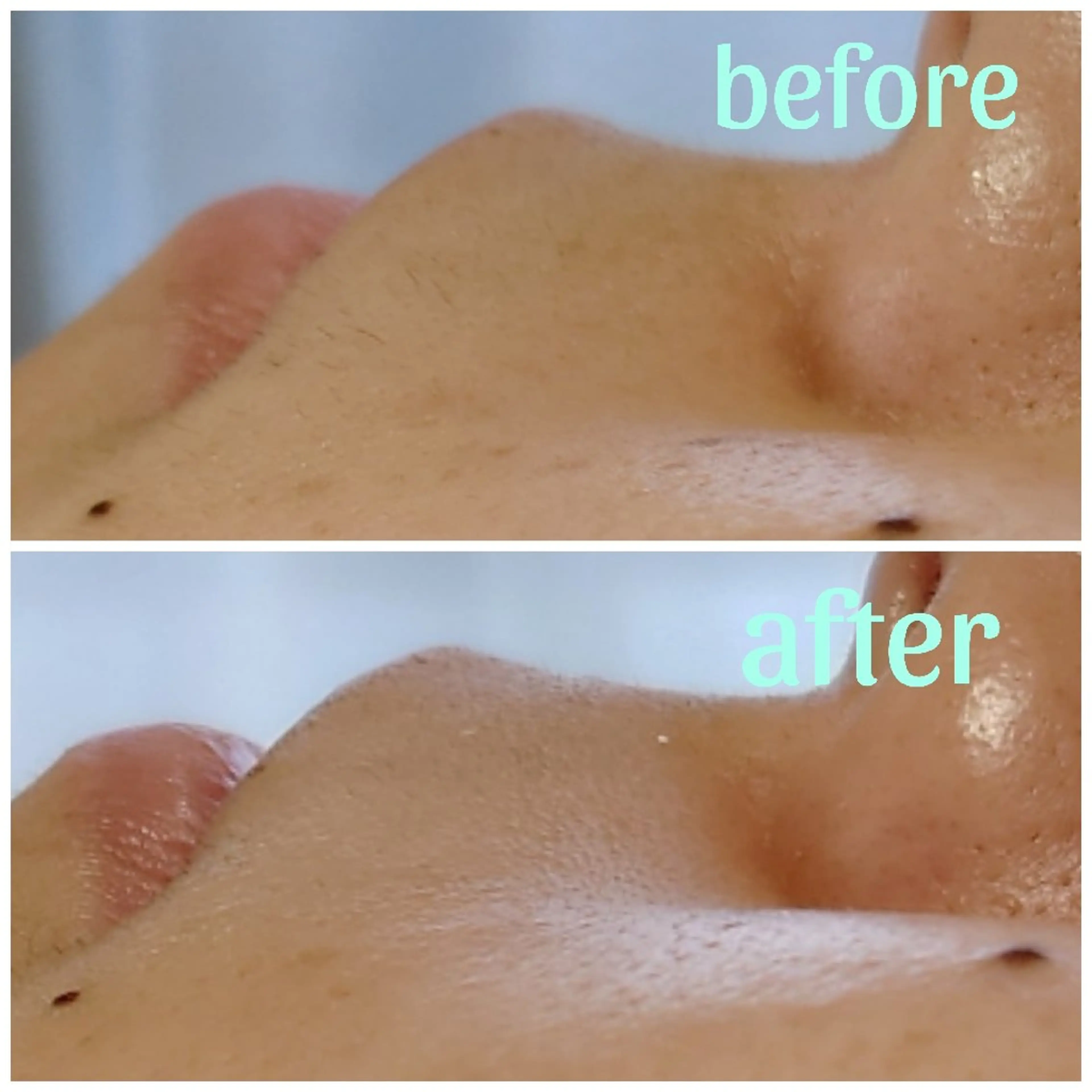 脱毛 ワックスのお家サロン Rimmelのエステ・リラクイメージ