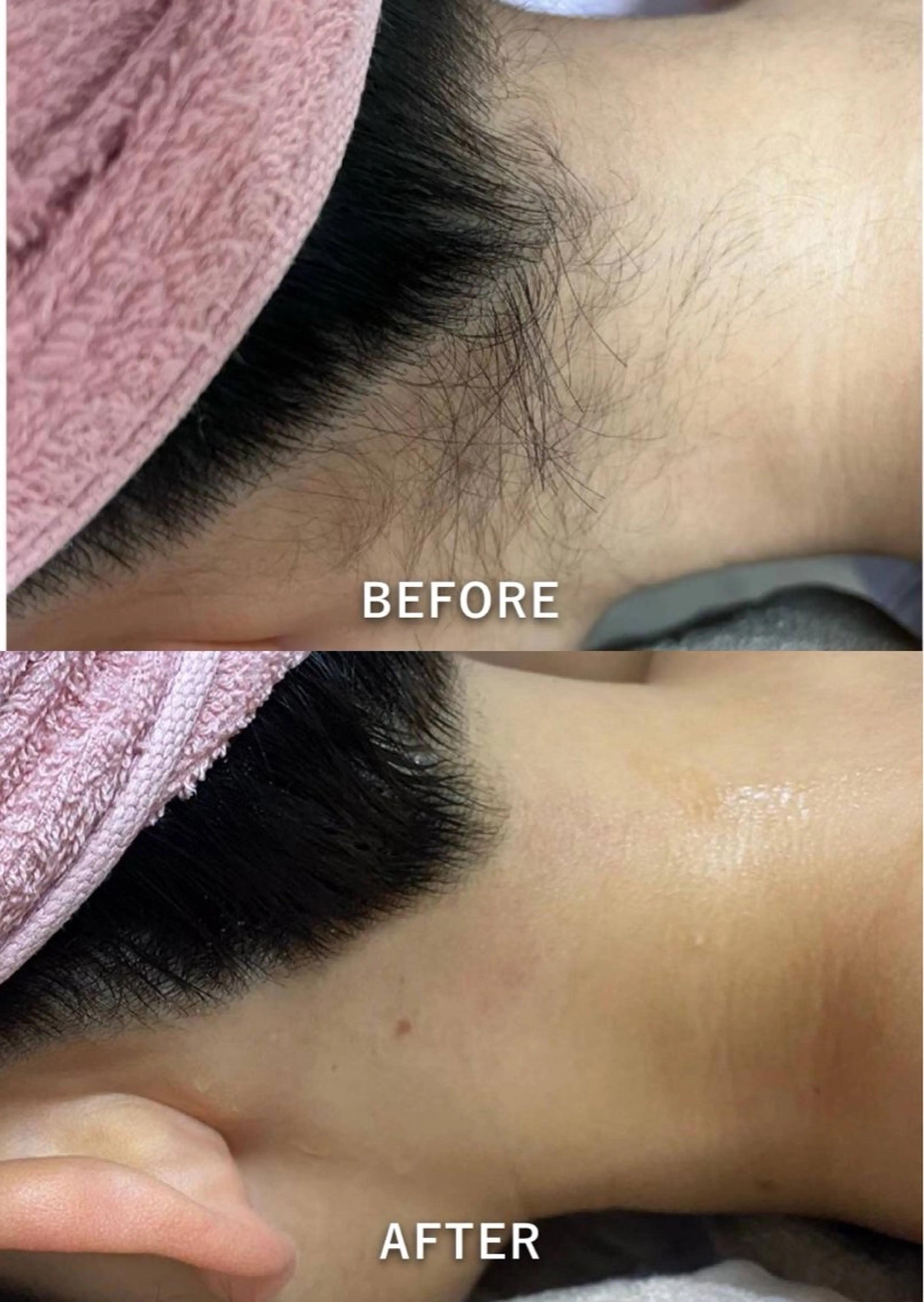 脱毛 salon de jessicaのエステ・リラクイメージ