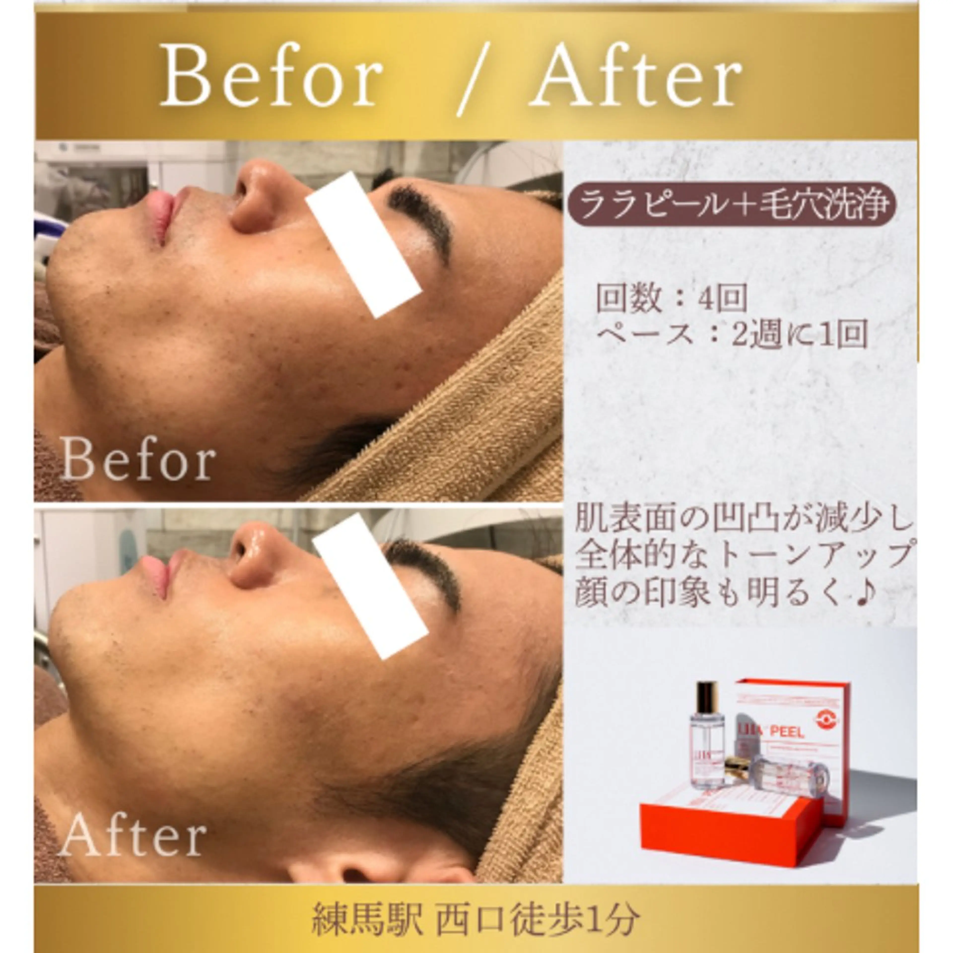 年齢肌/大人の肌管理 💎ぷるる練馬/山口のエステ・リラクイメージ