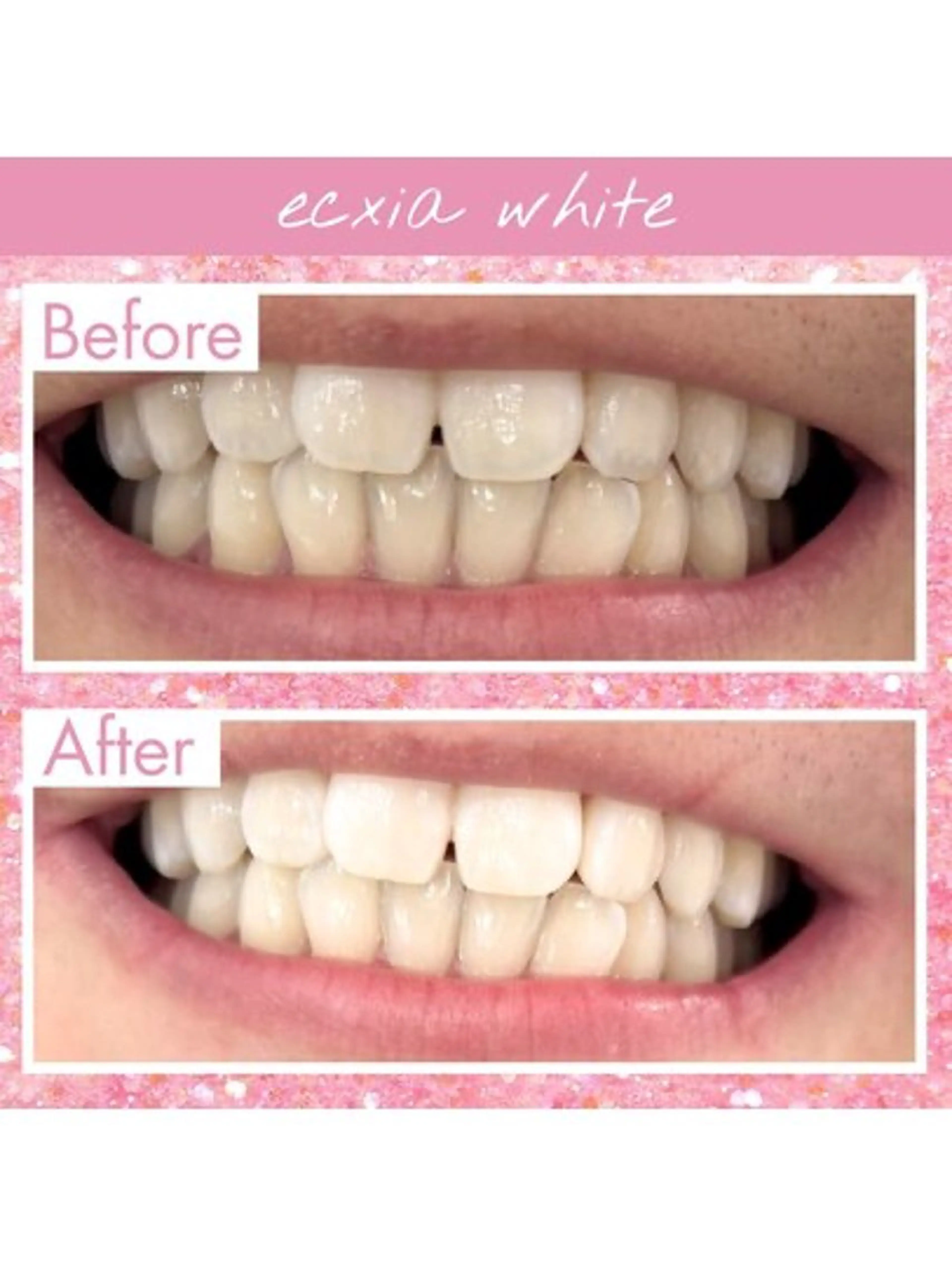 エクシア ホワイトニング西条店のその他イメージ