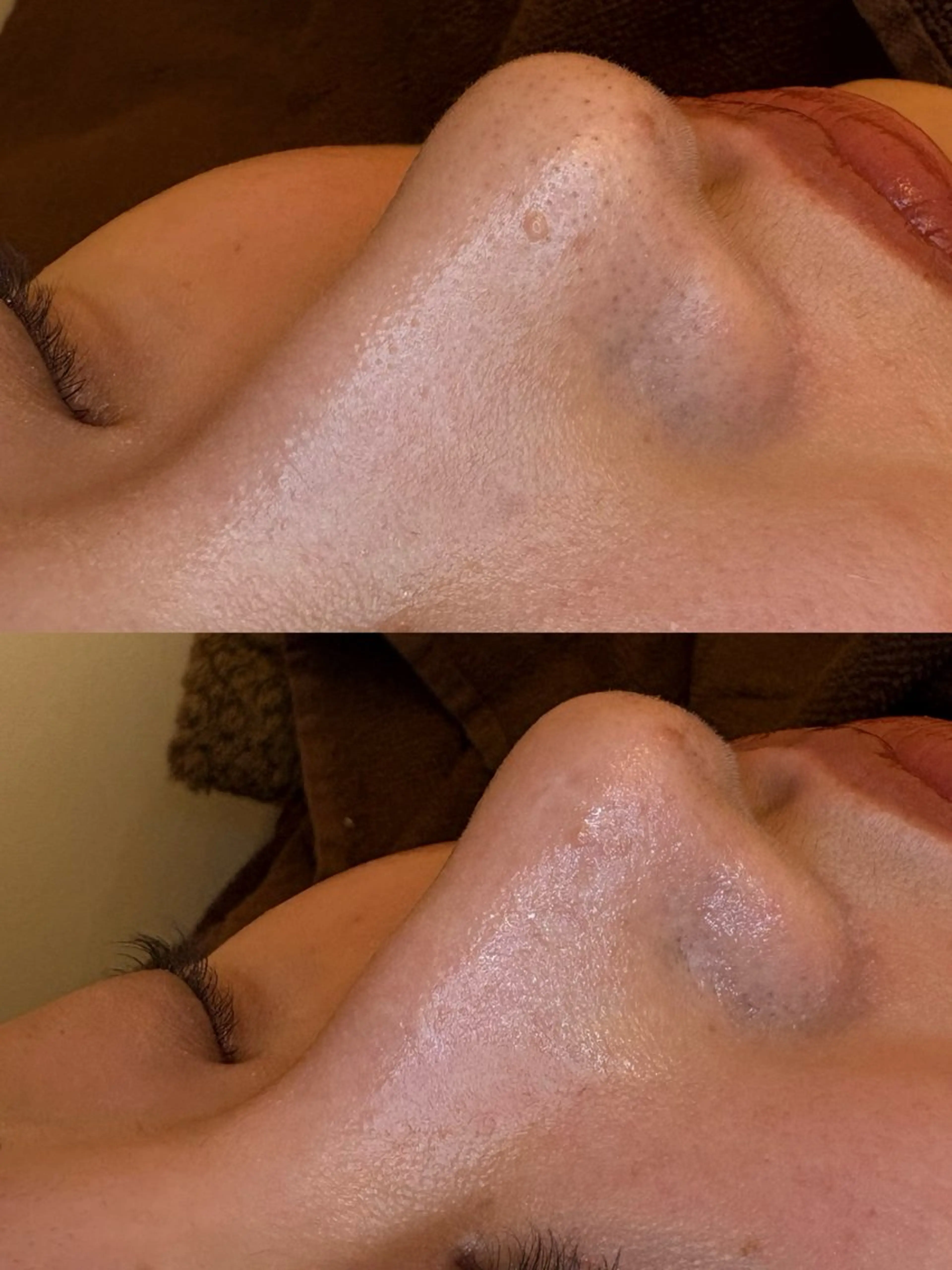 🤍アベシュリ /フェイシャル🤍のエステ・リラクイメージ