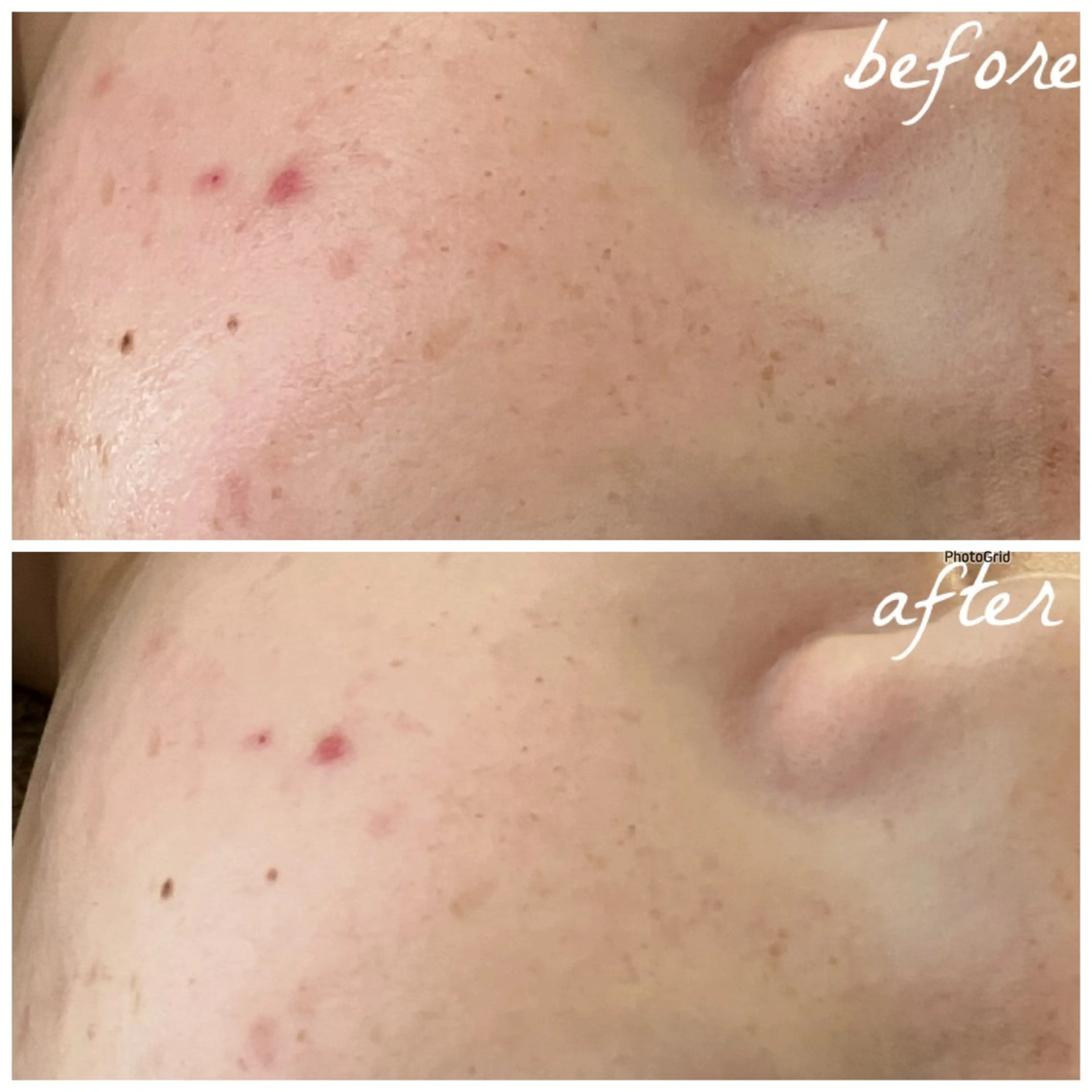 メンズ エステ メナード岐阜茜部 杉浦のエステ・リラクイメージ