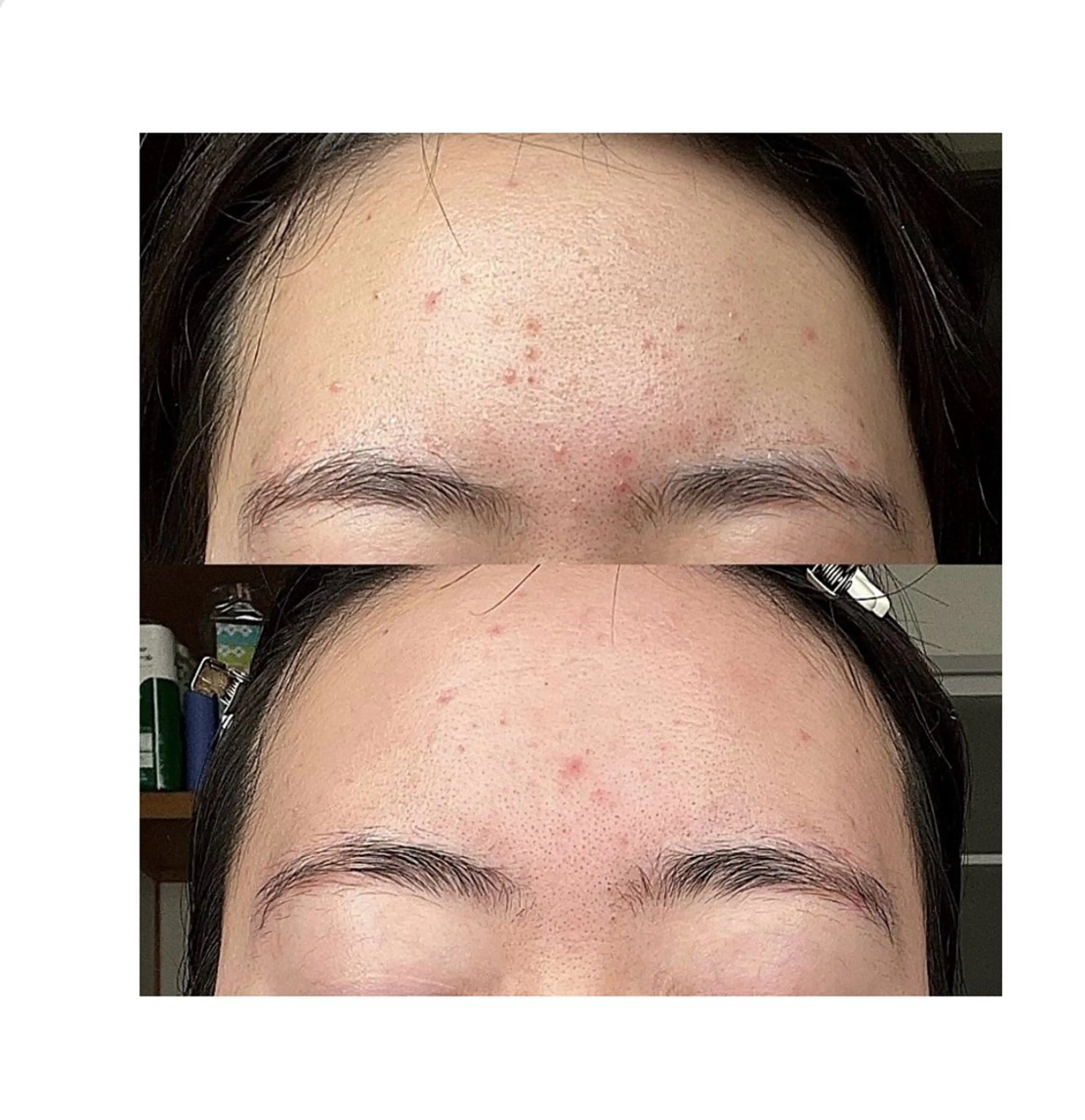 メンズ メンズ韓国風 エステ Queen Salonのエステ・リラクイメージ