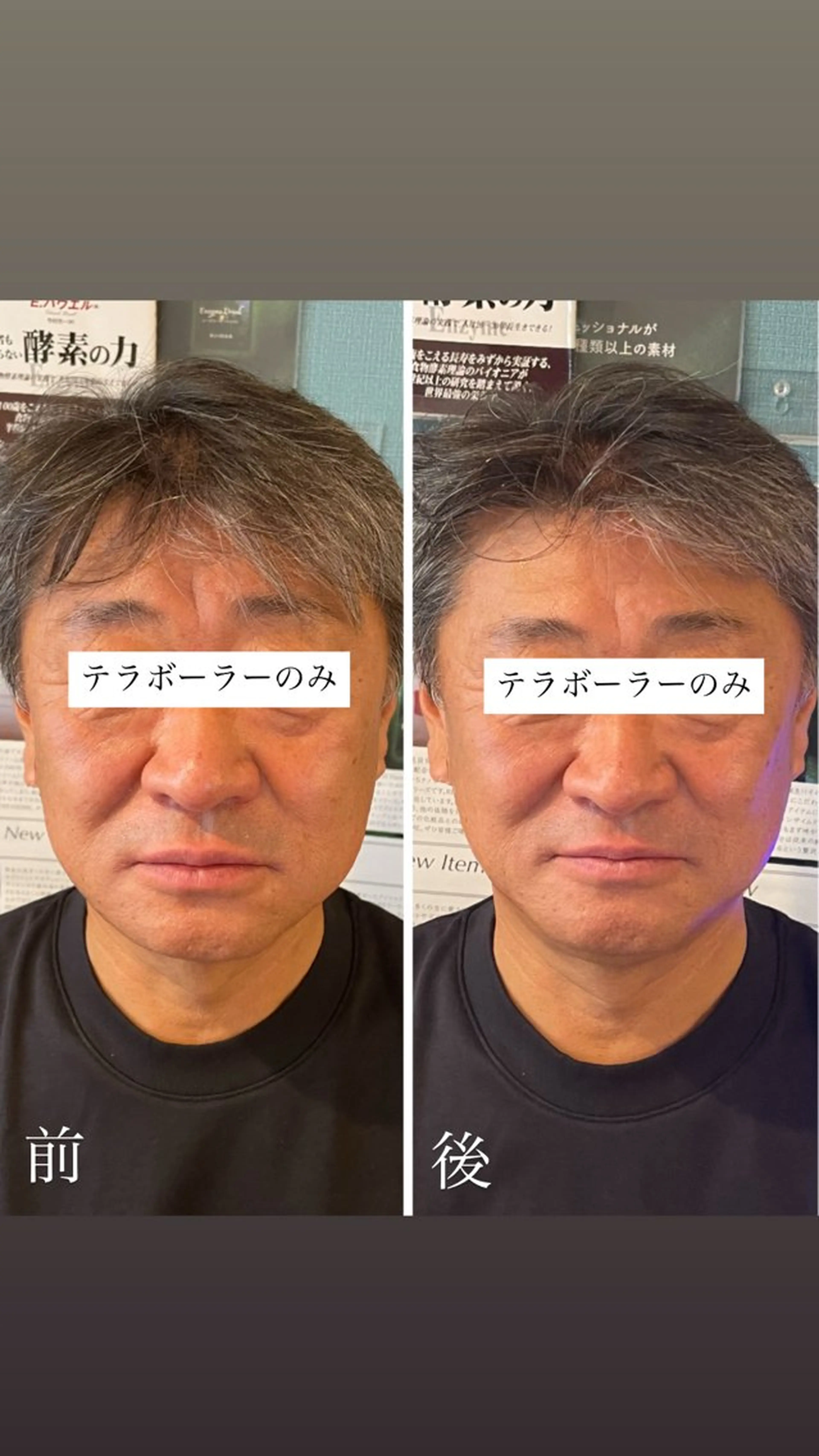 その他 耳ツボ/体質改善/ 温活La mer月島のその他イメージ