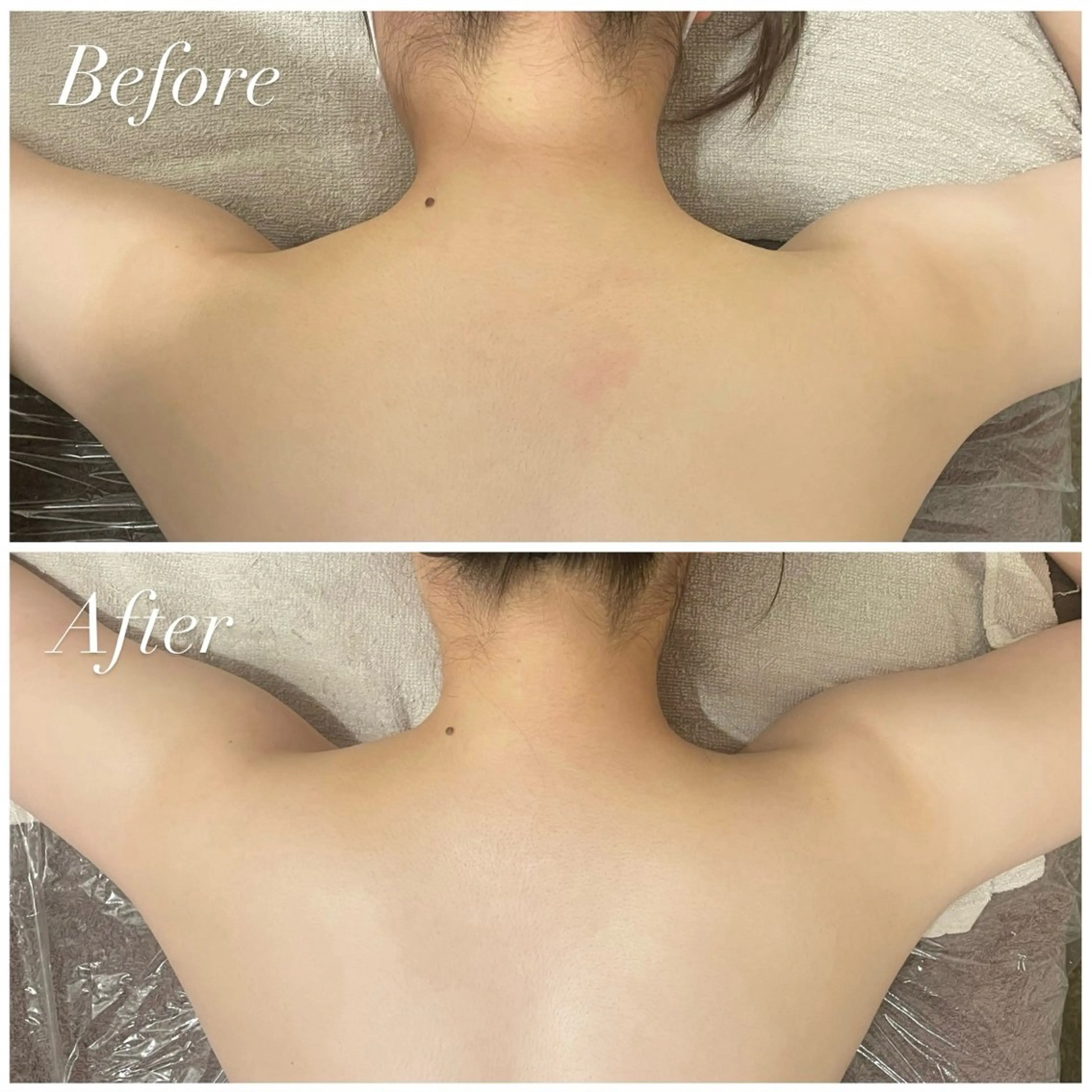 【18~29歳女性限定❣️】リンパドレナージュ⭐️の写真