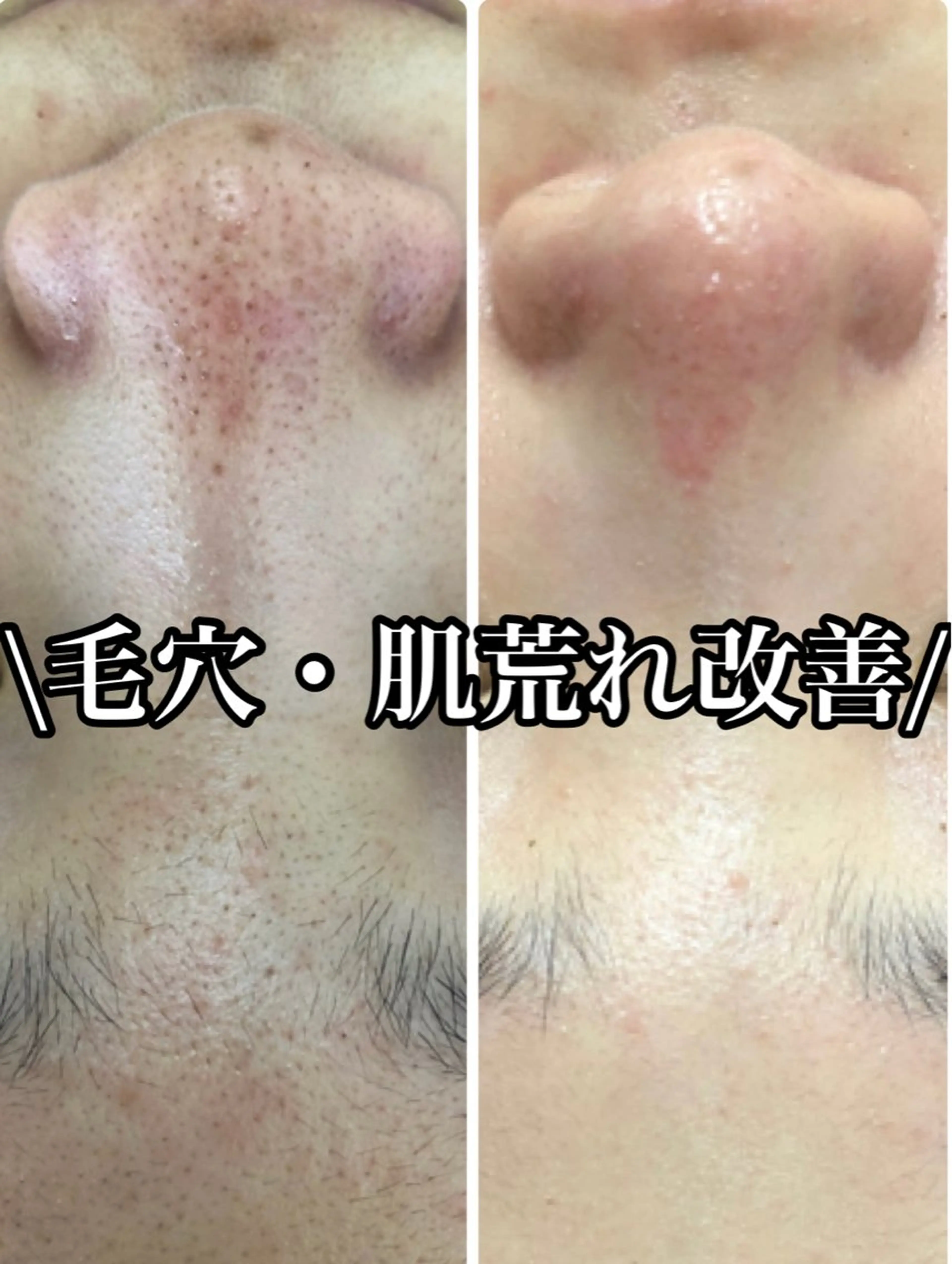 エステ LILIANA ☆YURIのエステ・リラクイメージ