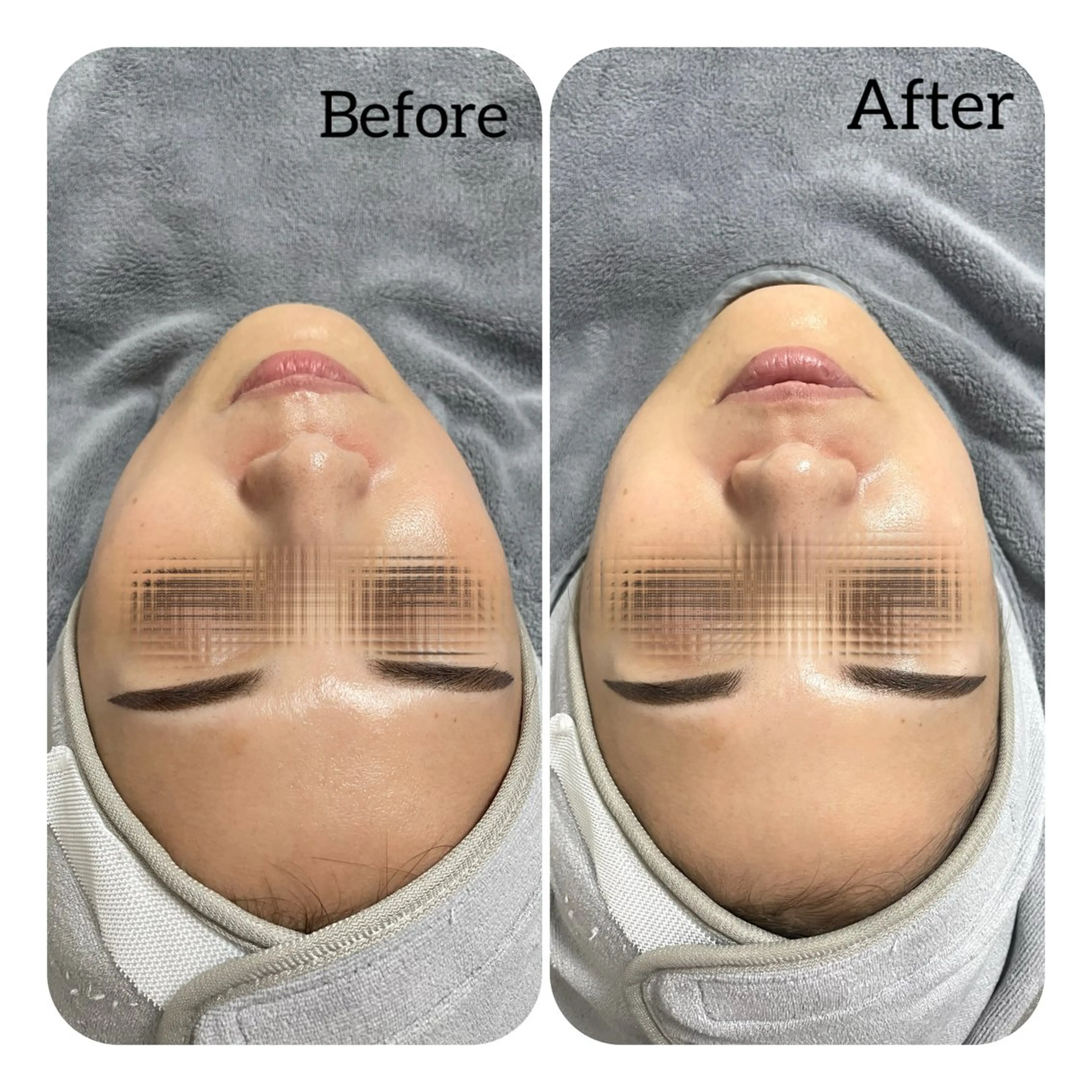 エステ Éclat de Belle🫧白玉肌のその他イメージ