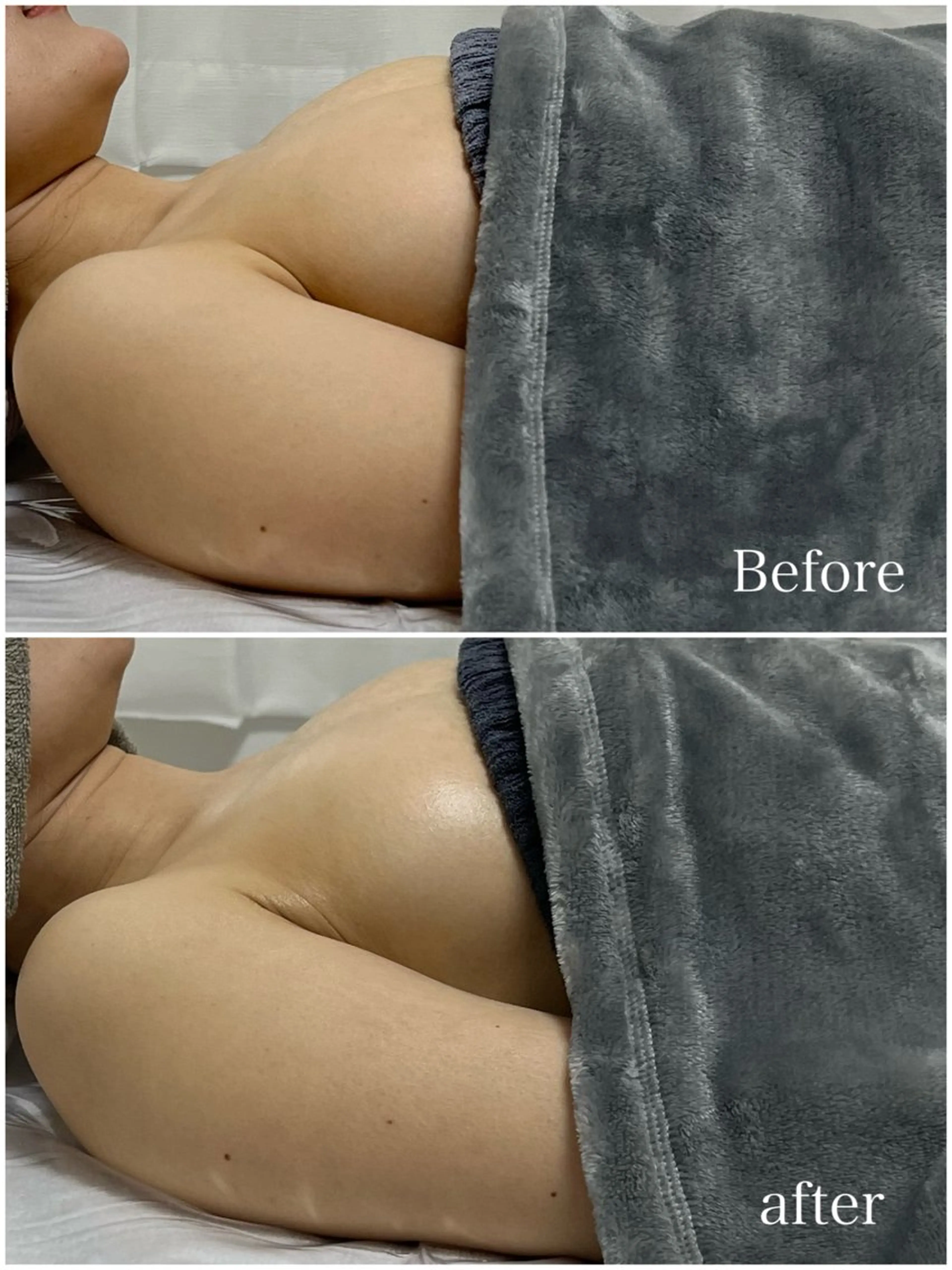 【育乳×全身ケア】オールハンドバストケアの写真