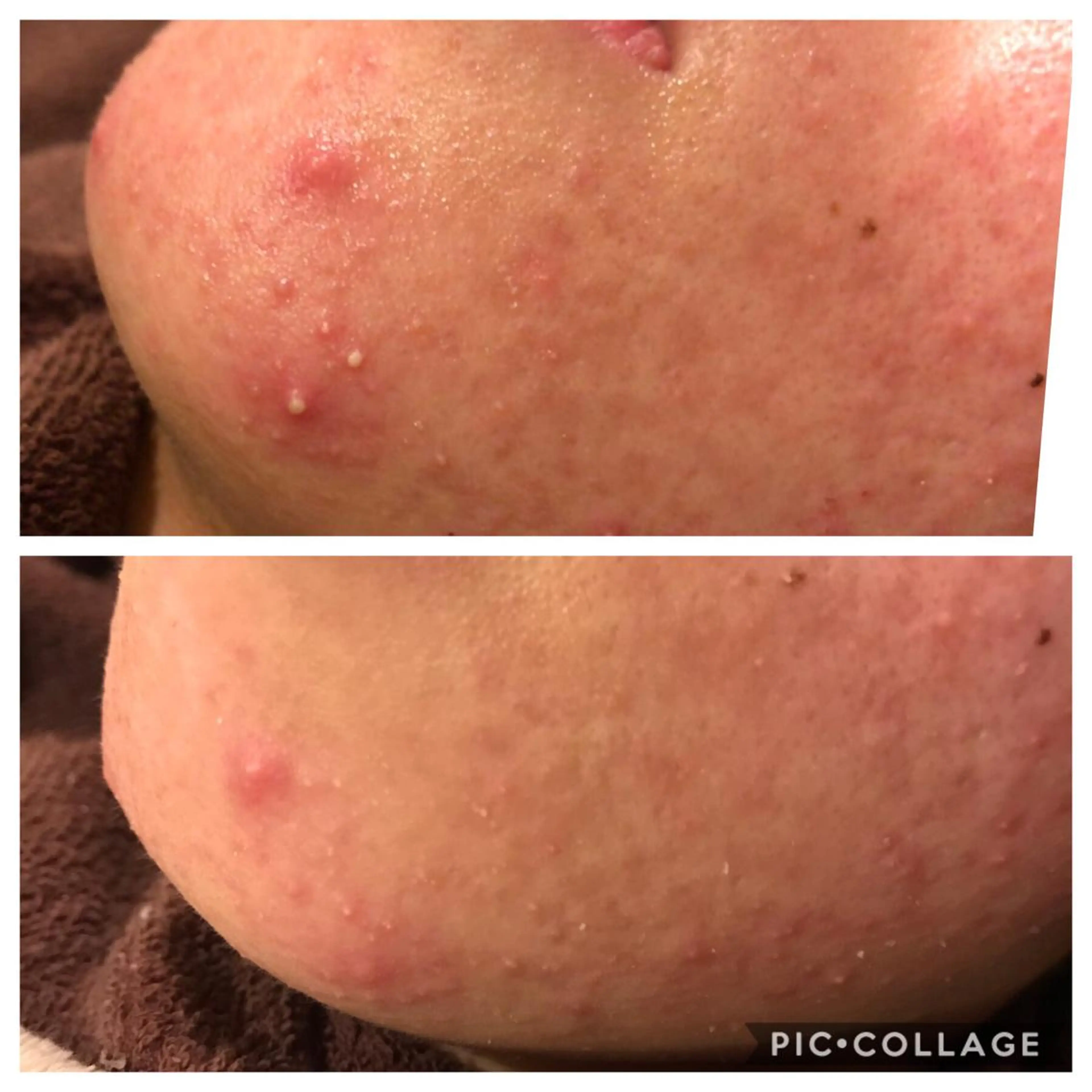 セミロング カラー パーマ ヘアアレンジ メンズ キッズ ネイル マツエク・マツパ 金の糸脱毛 産毛ケア専門のエステ・リラクイメージ