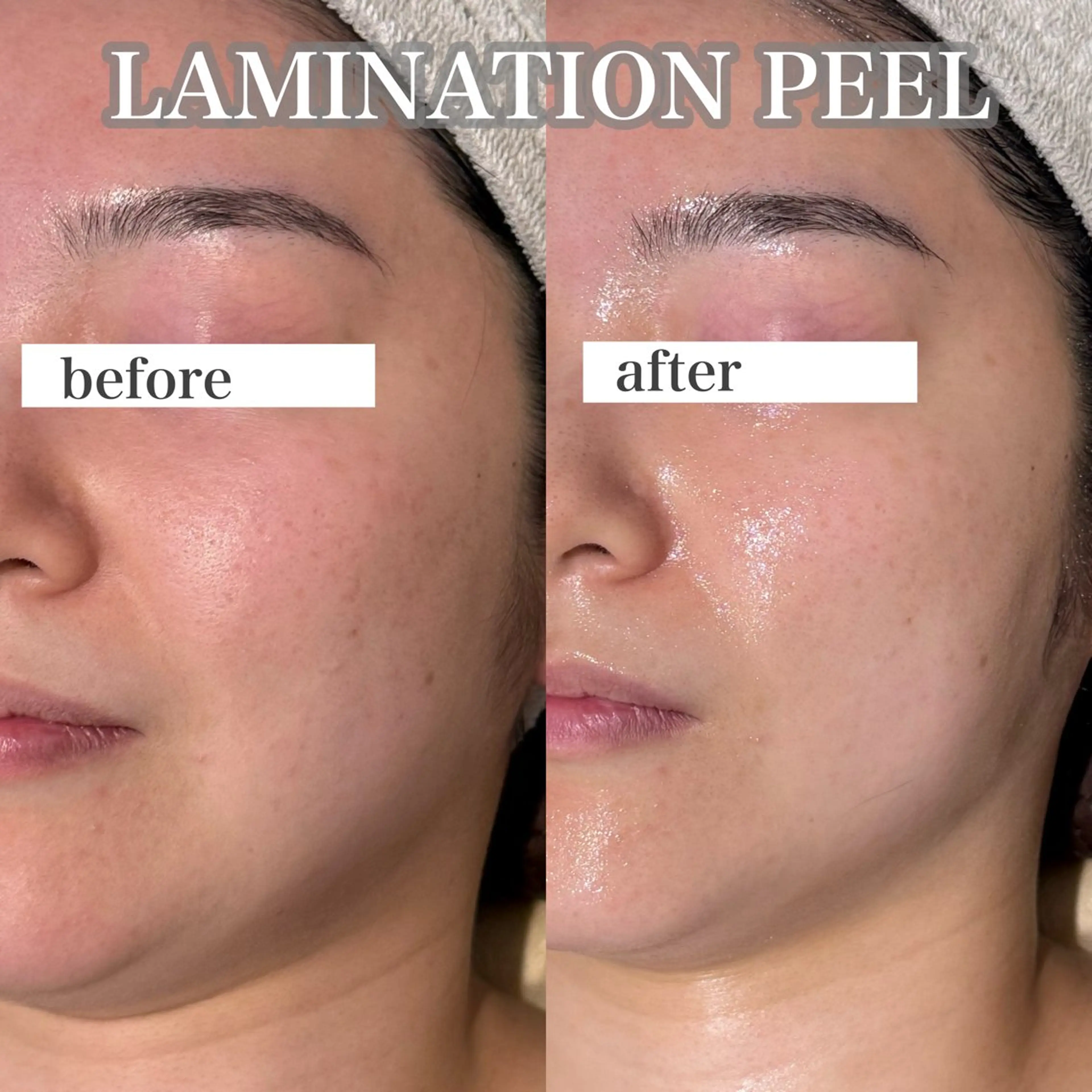 エステ 東大阪/韓国肌管理/ 痩身バスト専門店のエステ・リラクイメージ