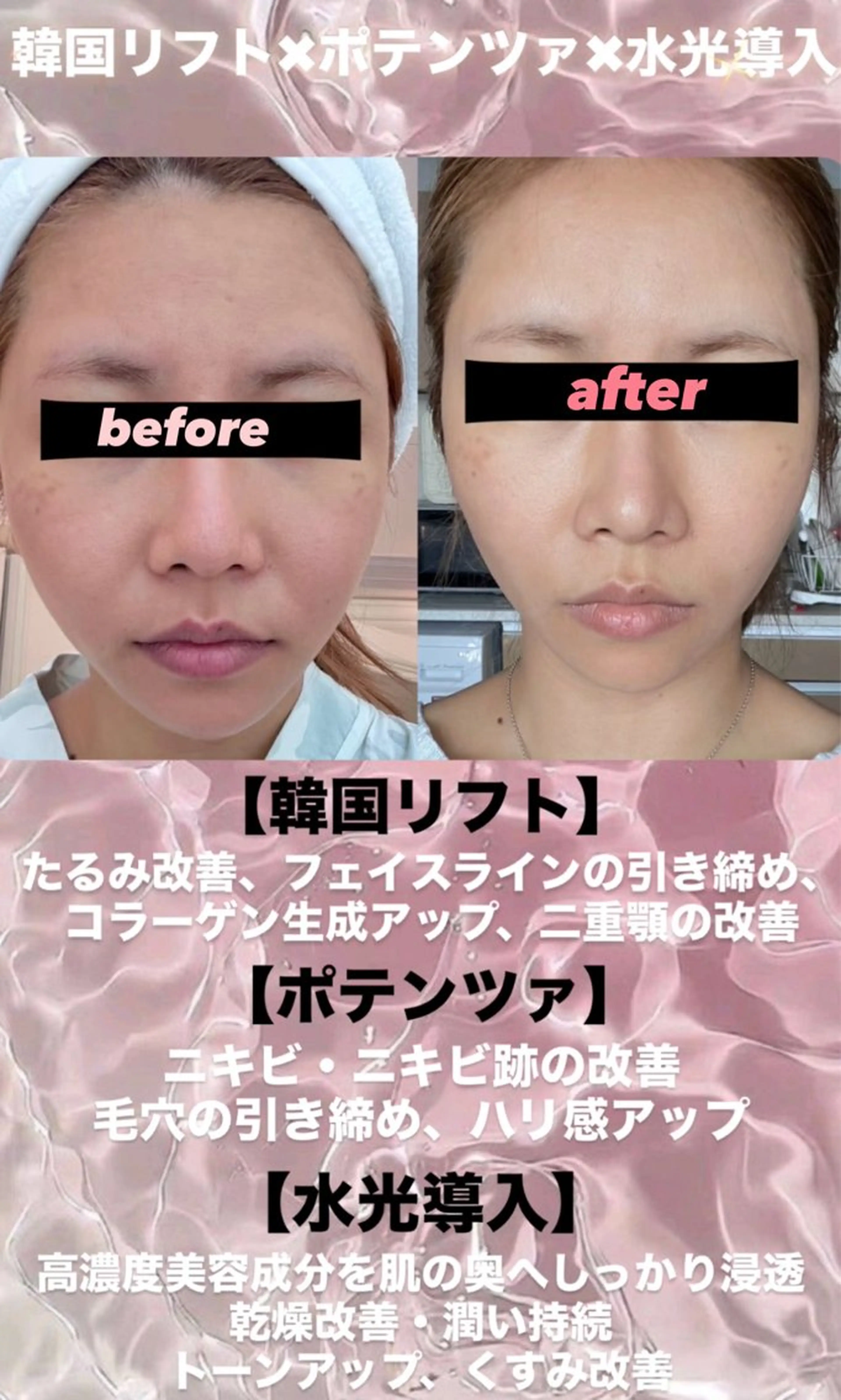 マツエク・マツパ エステ リラク 愛維美水光美肌専門店 メンズレディースokのエステ・リラクイメージ