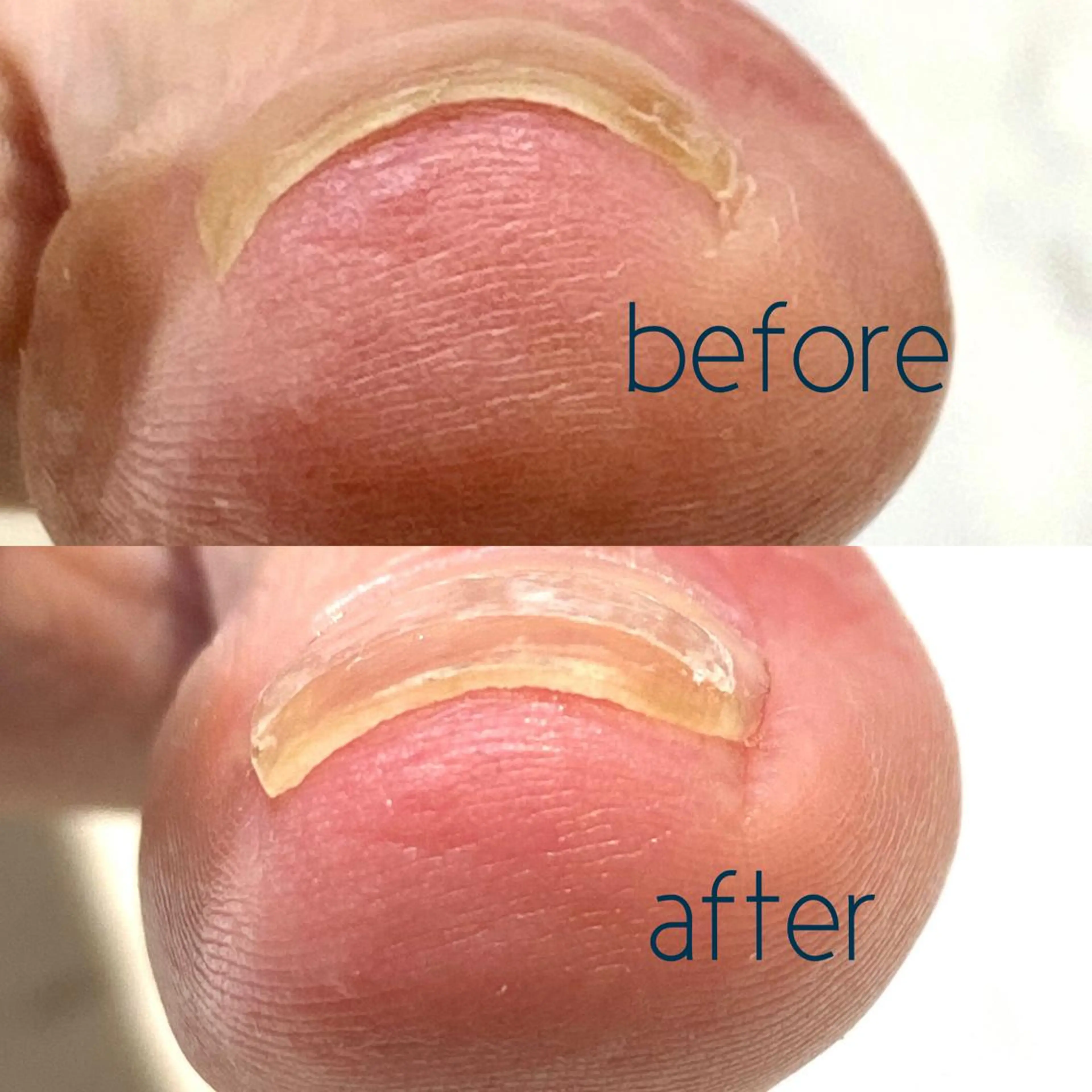 ネイル フットネイル プライベートサロン Rのネイルデザイン