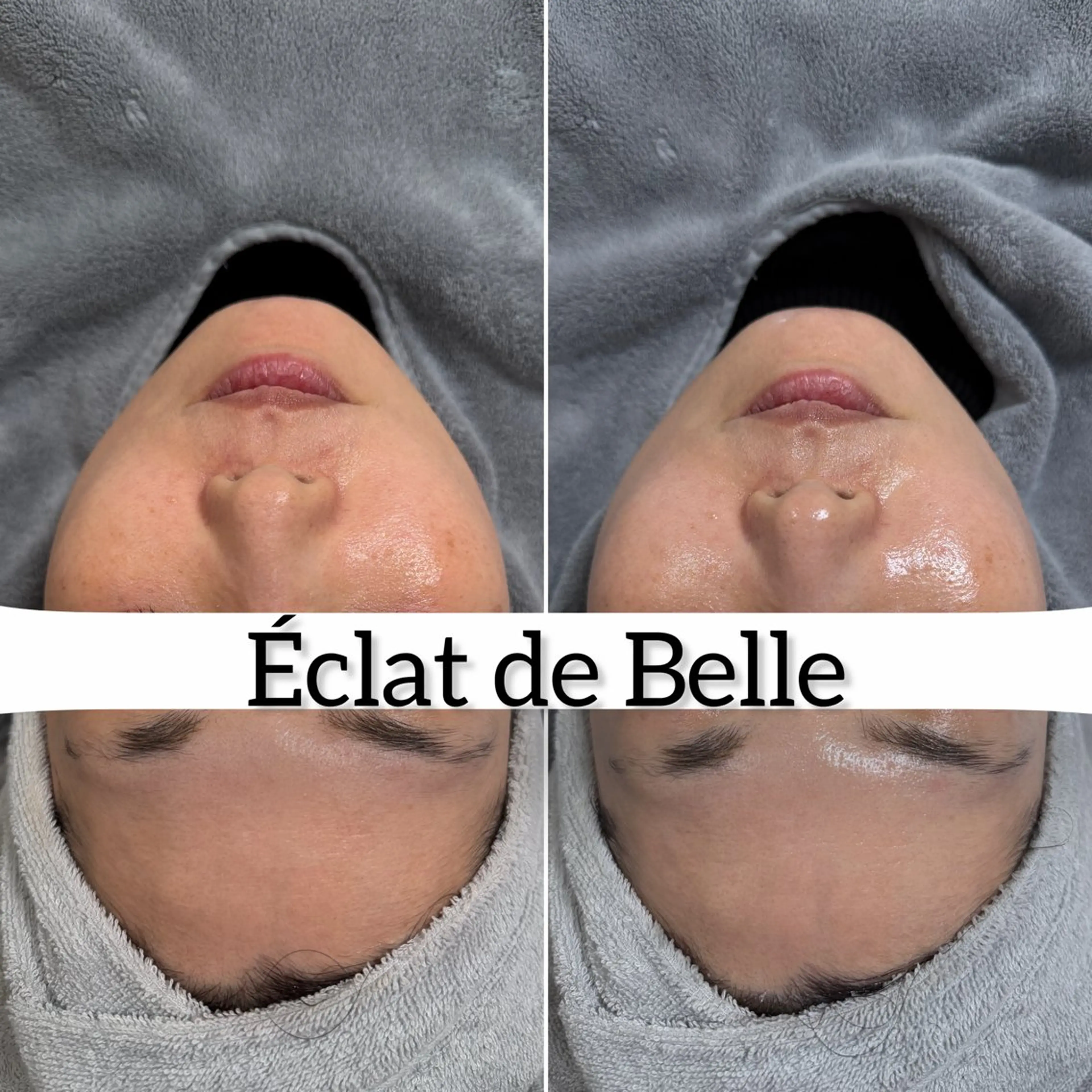 その他 Éclat de Belle🫧白玉肌のその他イメージ