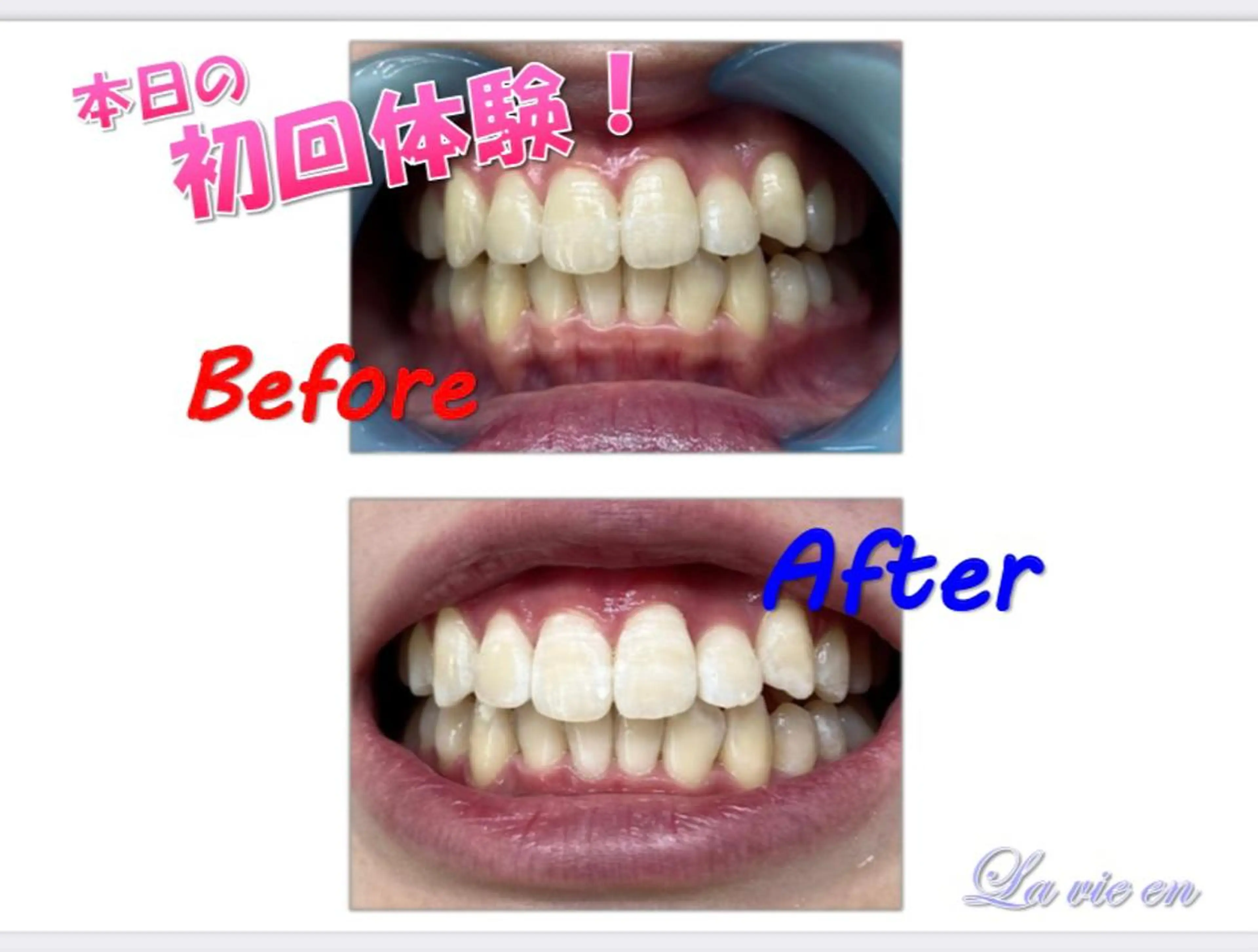 その他 ホワイトニングサロン La vie enのその他イメージ