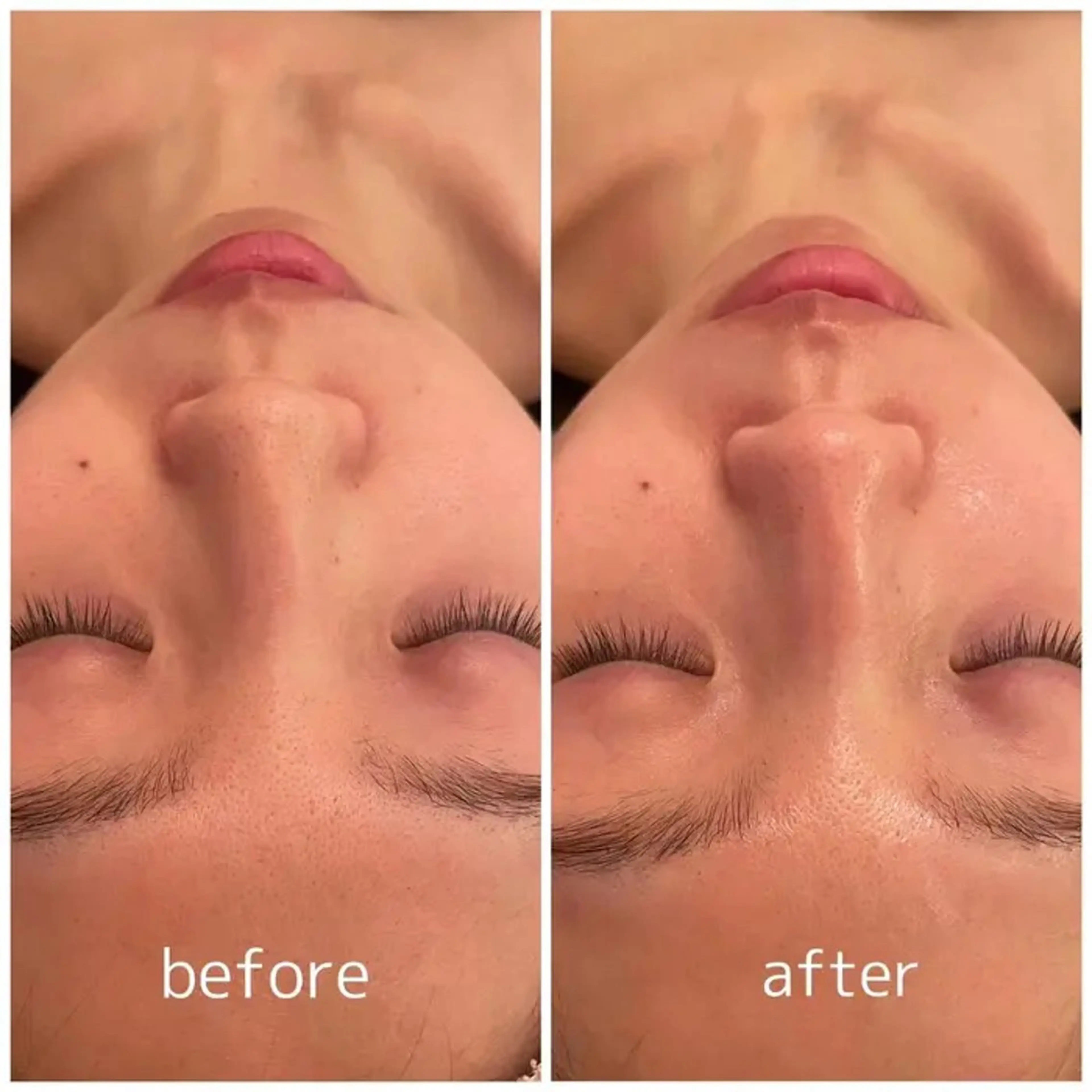 脱毛 Noguchi staffのエステ・リラクイメージ