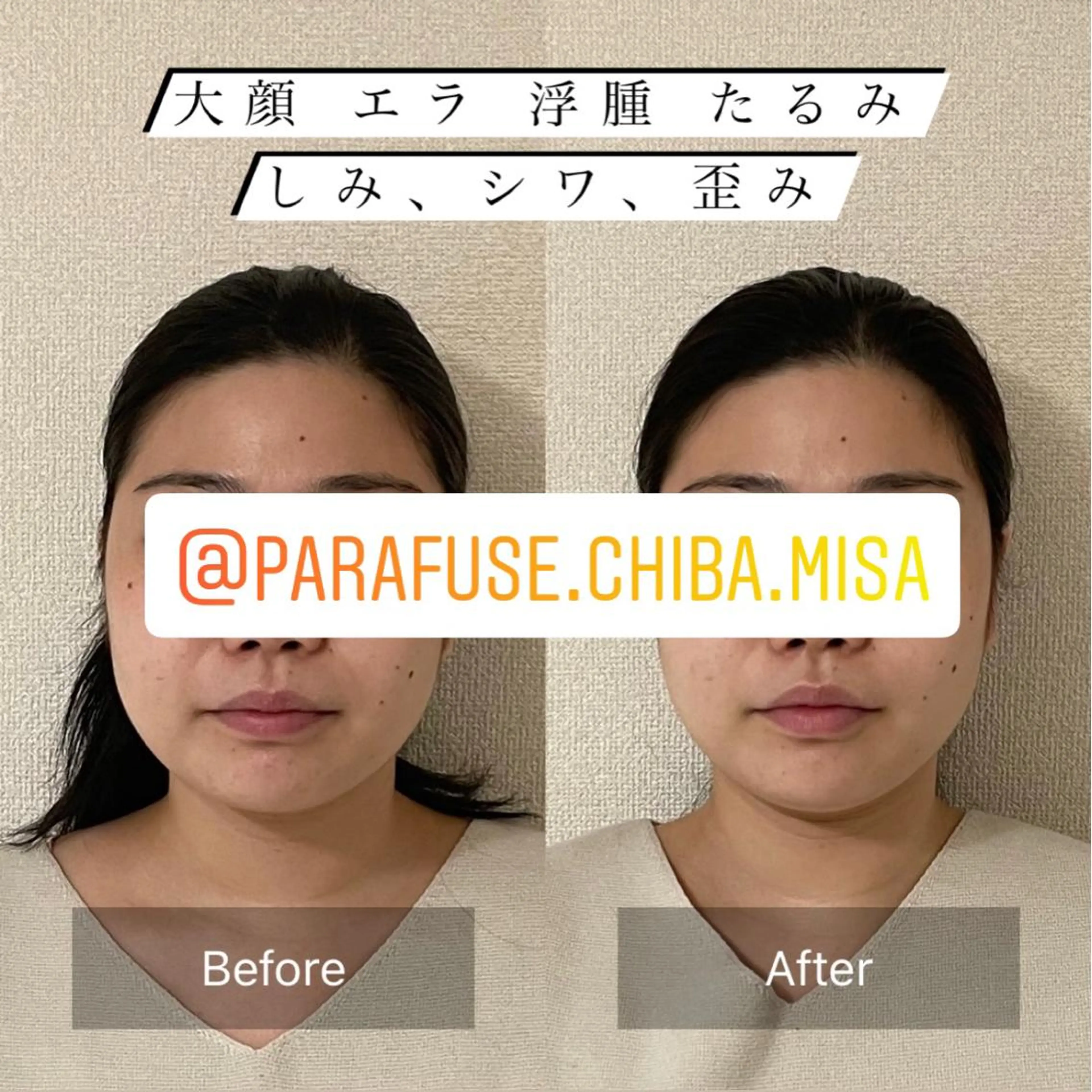 脳洗浄スタンダード✨ 快眠！薬を手放し健康体へ！小顔小頭は必須です💕の写真