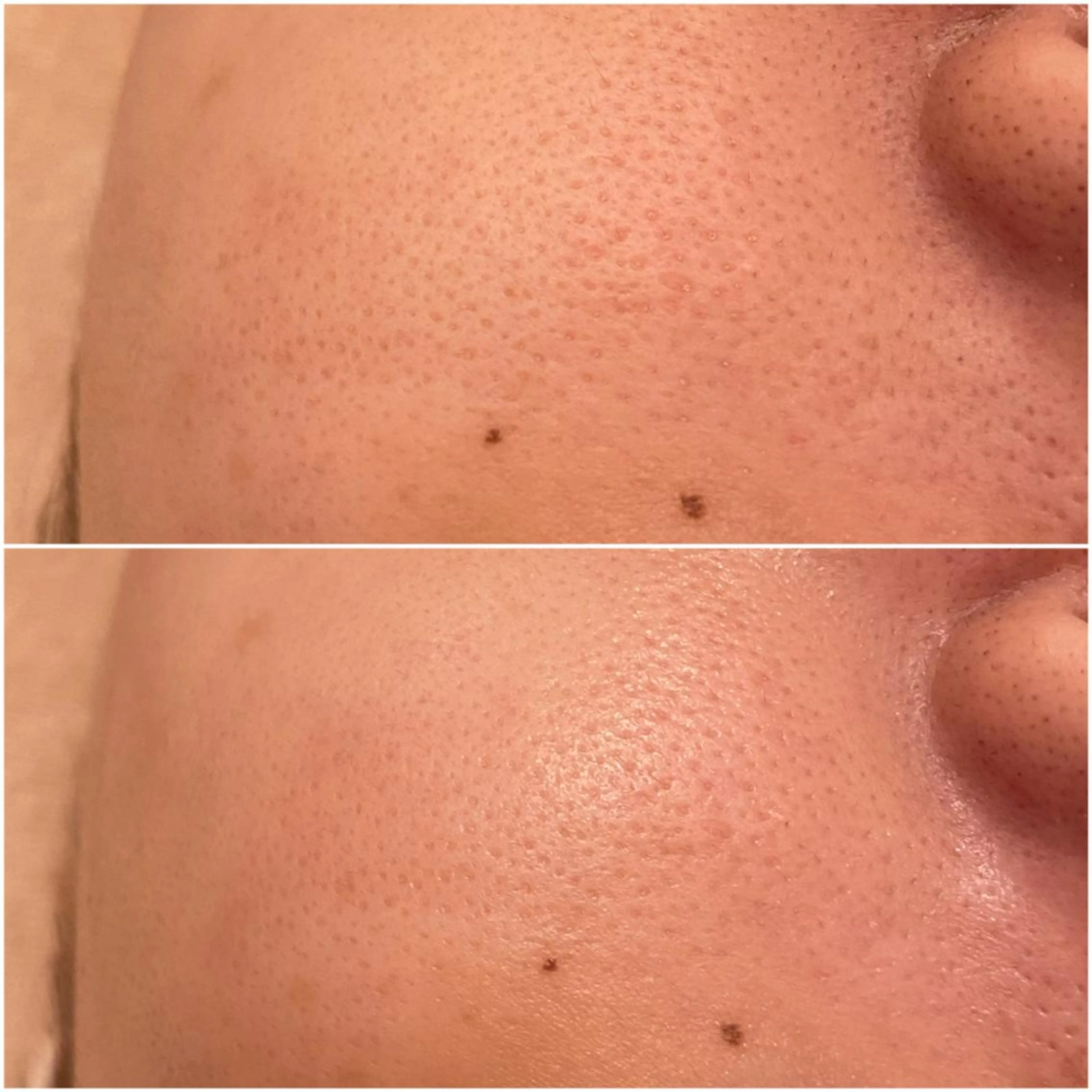 エステ ララ/ハーブ メゾンリュバンのエステ・リラクイメージ