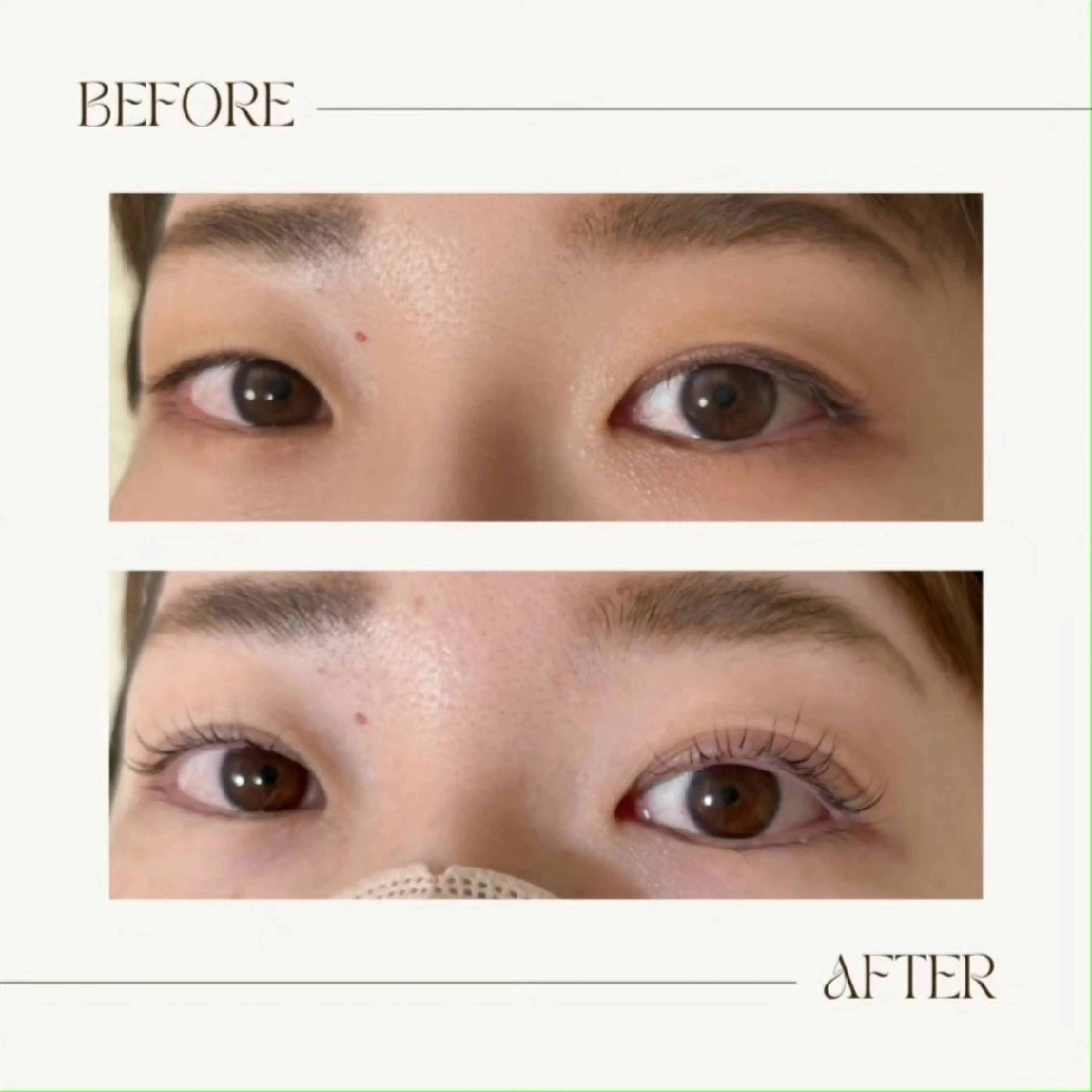 マツエク・マツパ マツパ Valon (chiharu)のマツエク・マツパデザイン