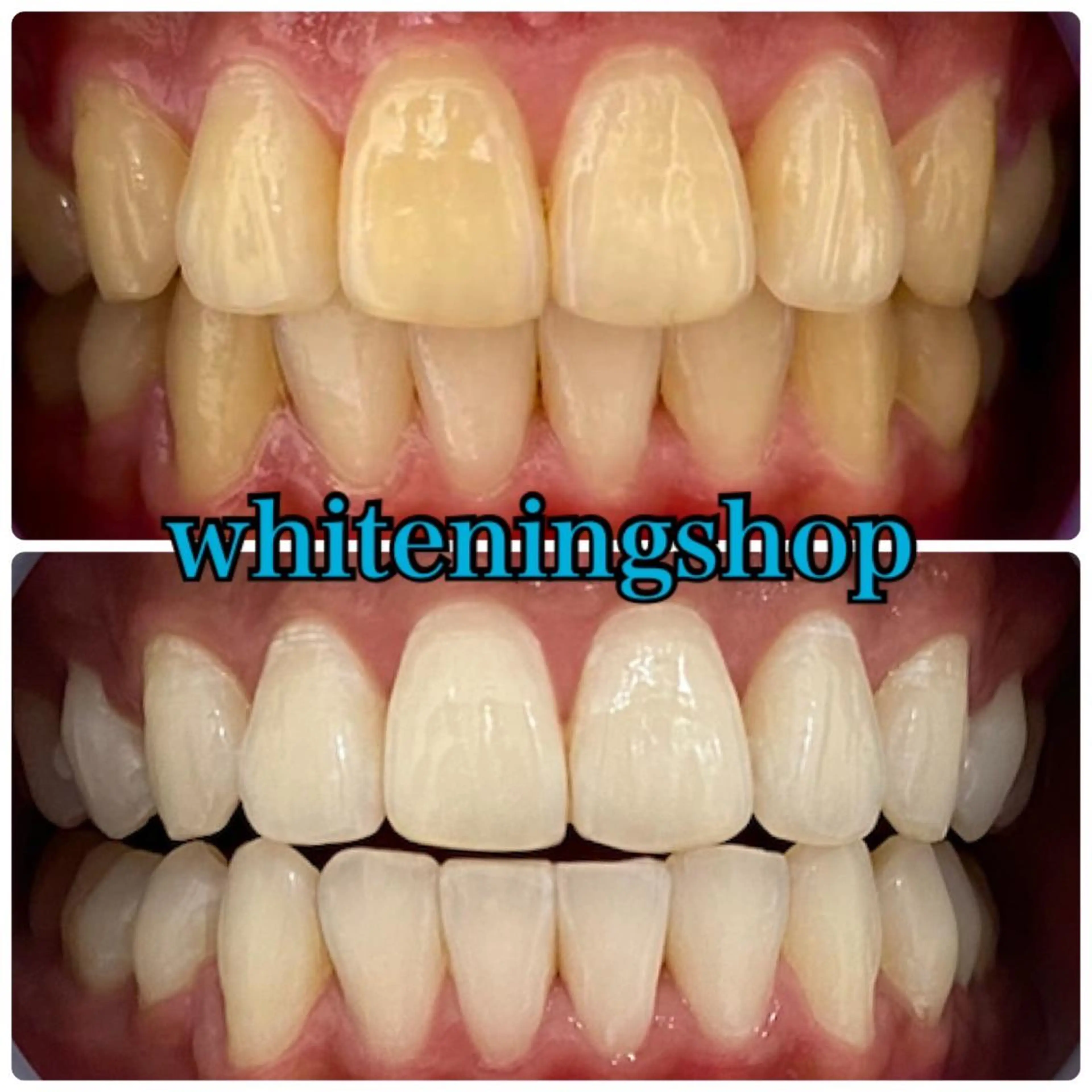 ホワイトニング ショップ吉祥寺店のエステ・リラクイメージ