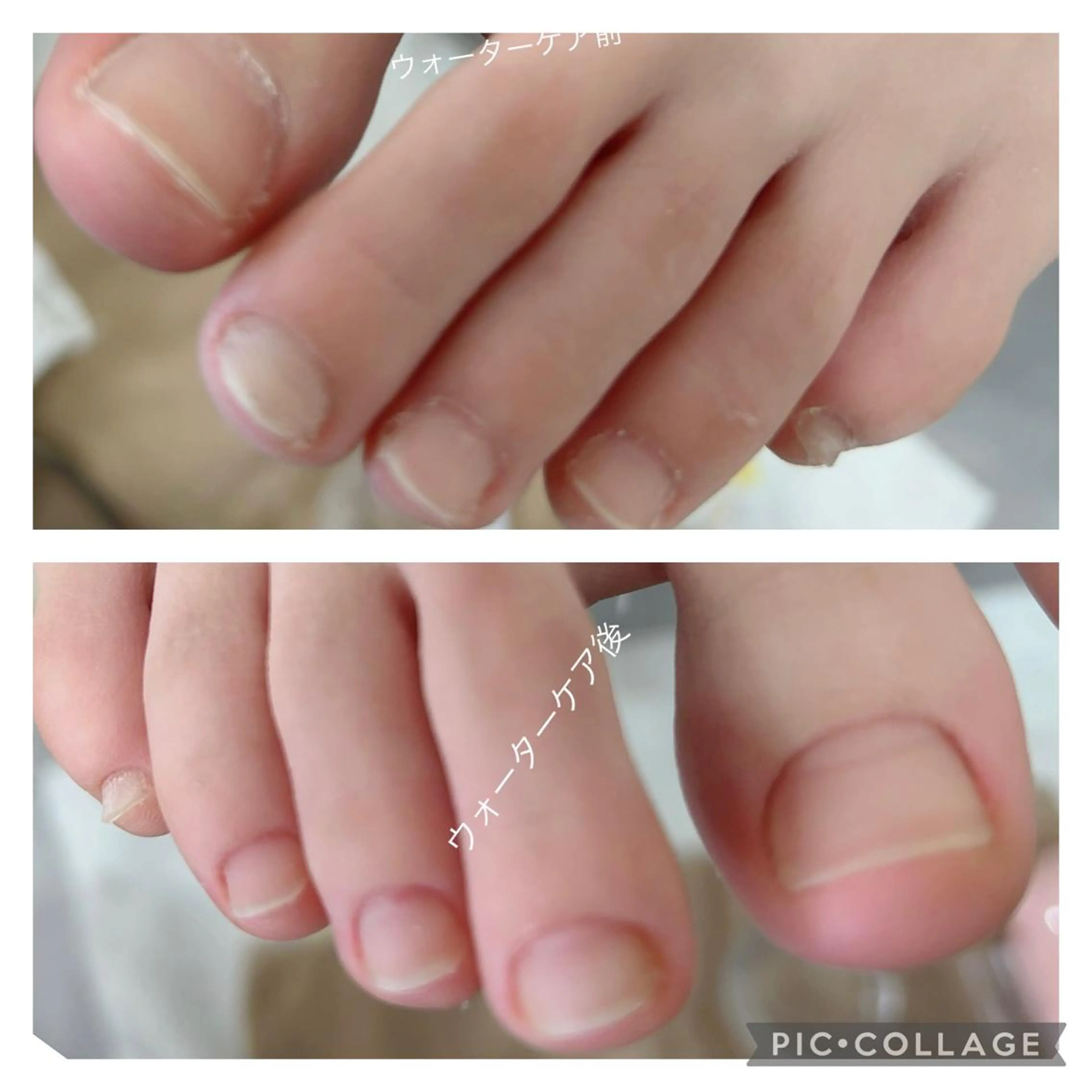 ネイル 北浦和 自爪育成ケアのネイルデザイン