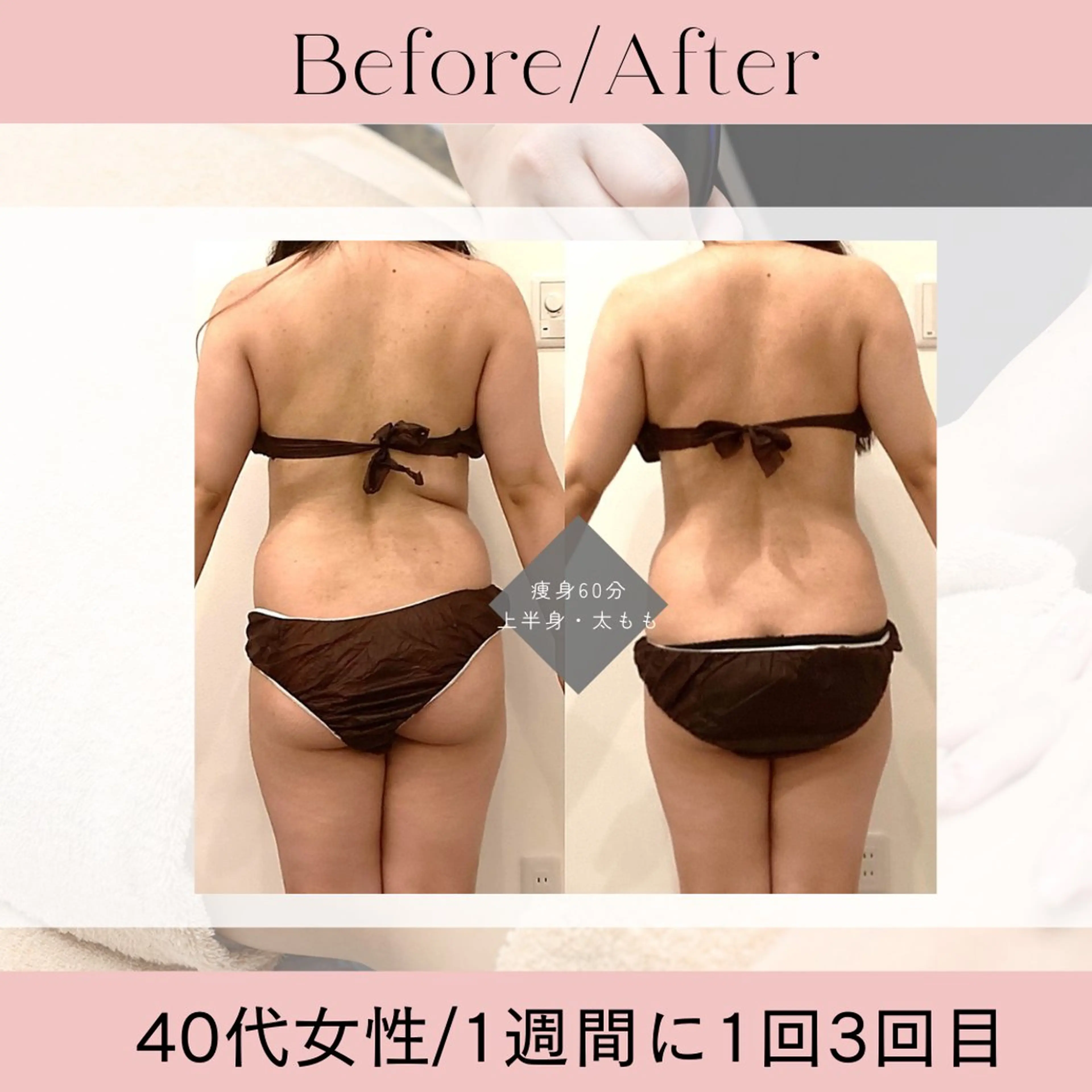 エステ リラク 痩身＆小顔サロン EXTREMITYのエステ・リラクイメージ