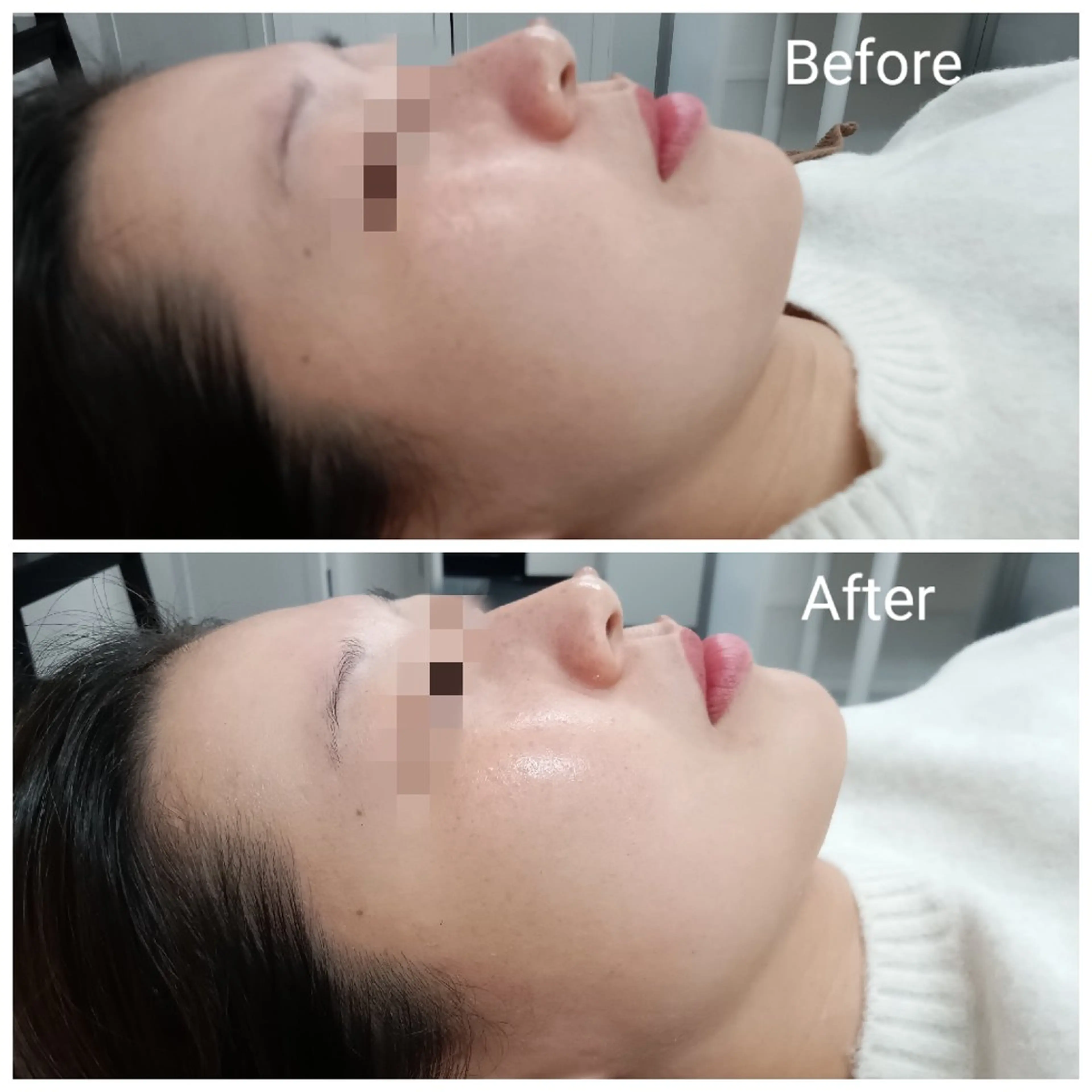 肌質改善Beauty salon Renのエステ・リラクイメージ
