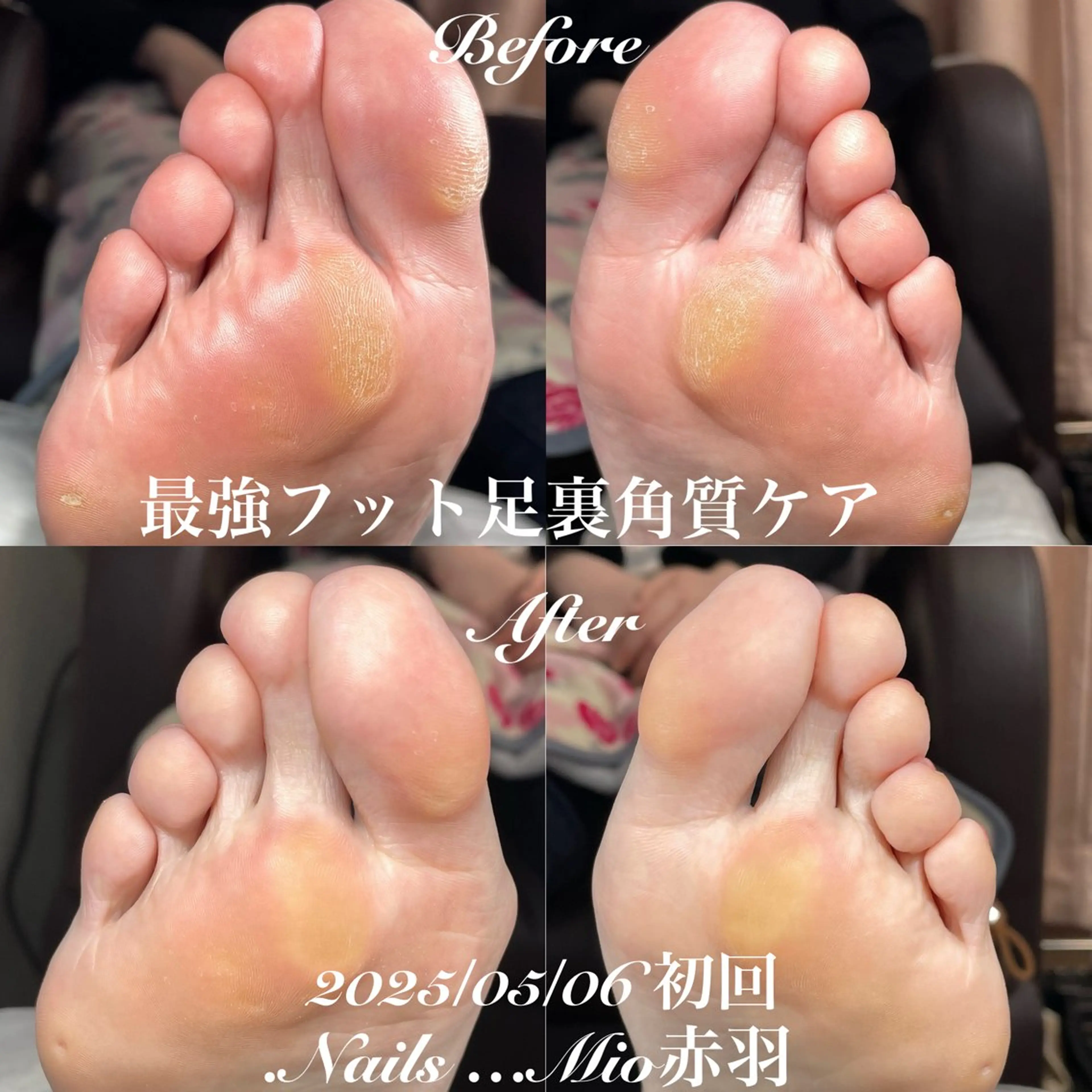 ネイル フットネイル 赤色 .Nails Mio 赤羽西ネイルサロンのネイルデザイン