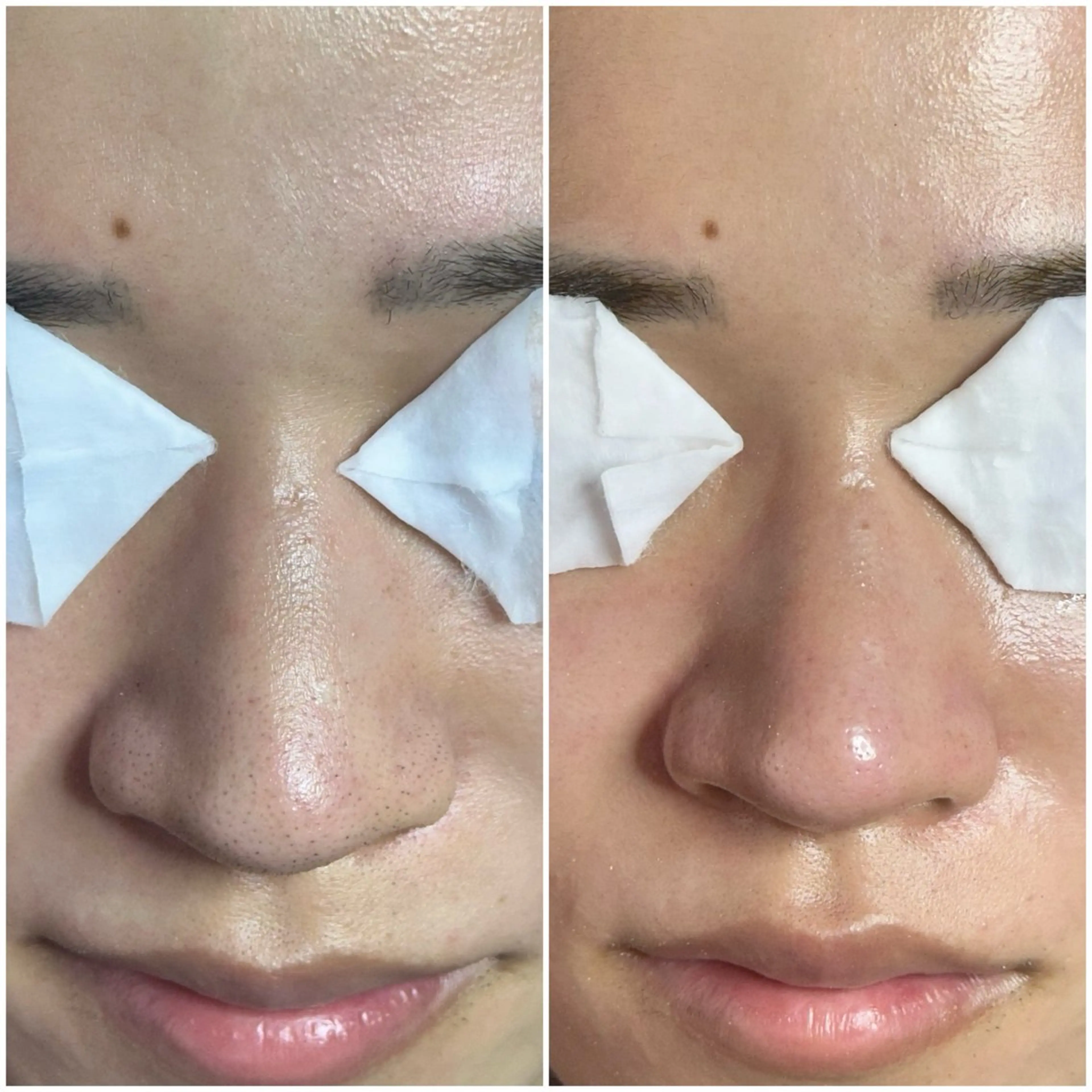 kanunu♡mana所属・豊橋/毛穴特化エステ 深層デトックスリンパのエステ・リラクイメージ