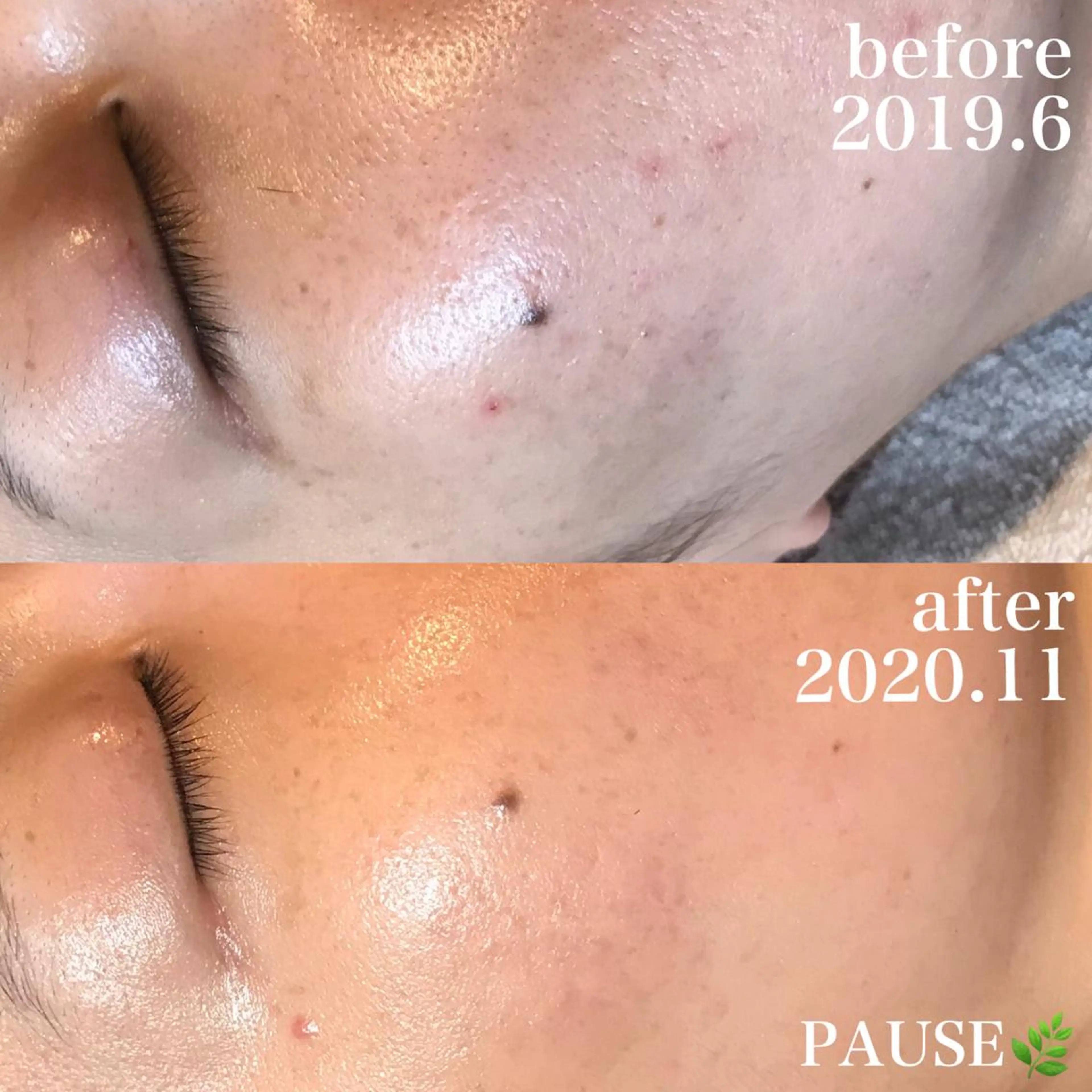 エステ 浜野 恵美のエステ・リラクイメージ