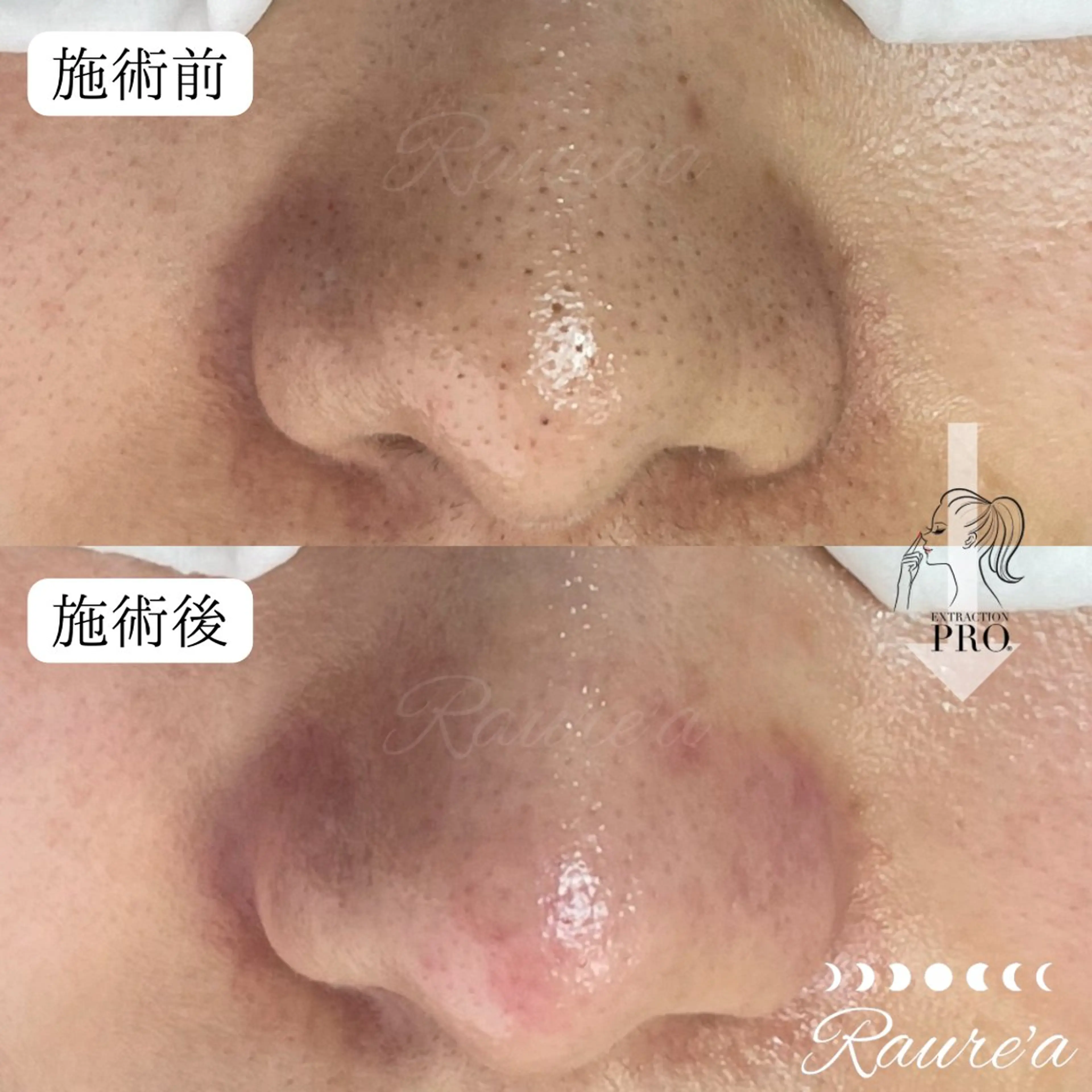 Raure'a Yurikoのマツエク・マツパデザイン