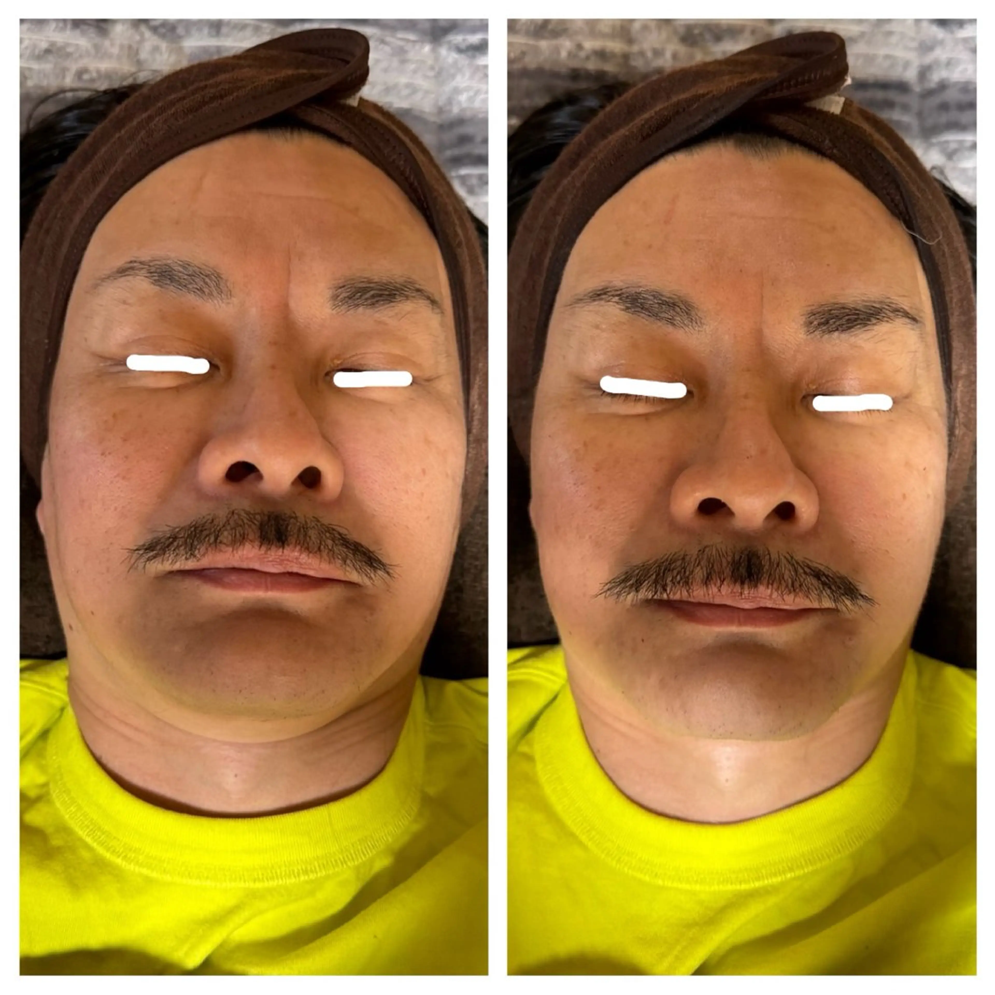 メンズ エステ 加藤 絵美里のエステ・リラクイメージ