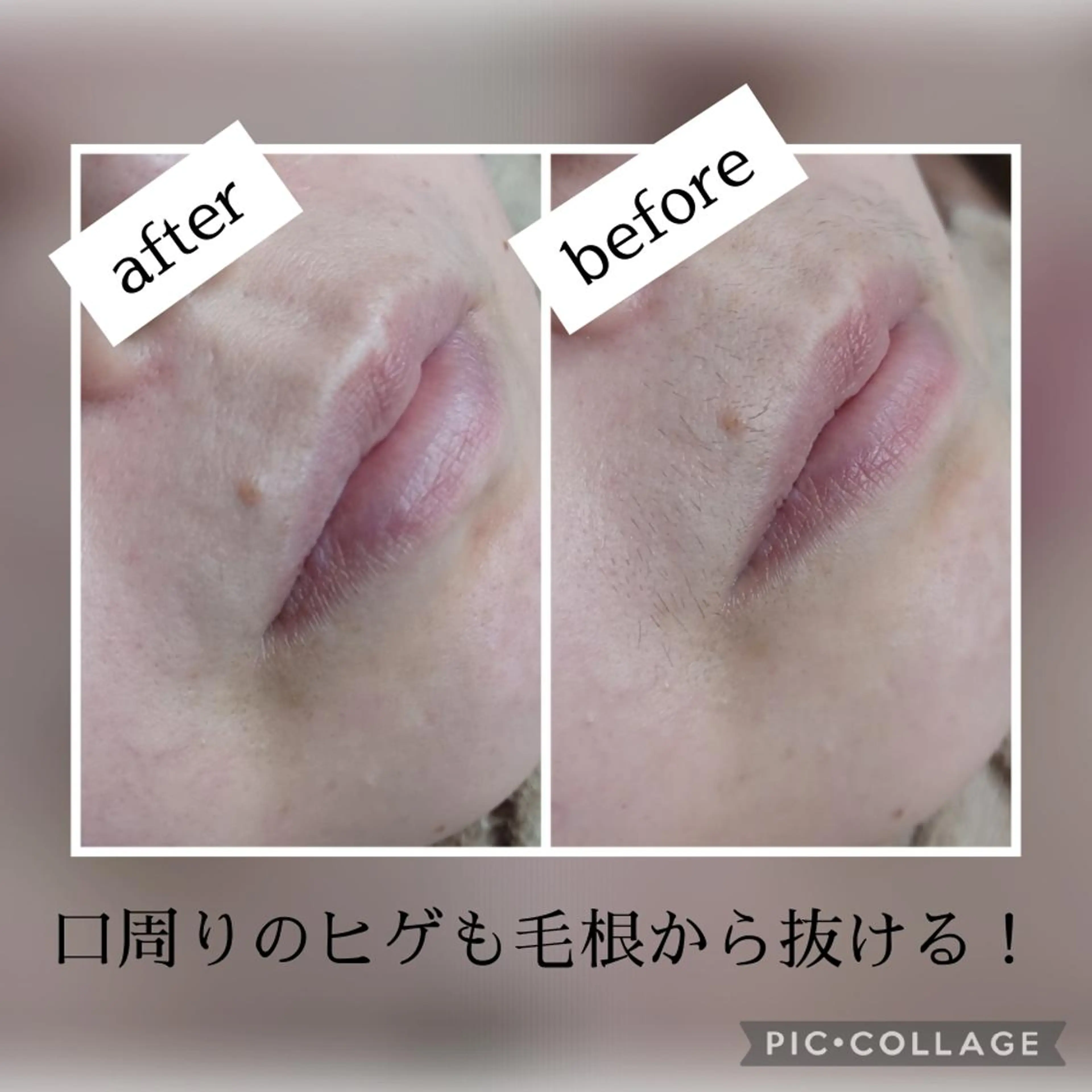 Lutella所属・ワックス脱毛専門店 Lutellaのエステ・リラクイメージ