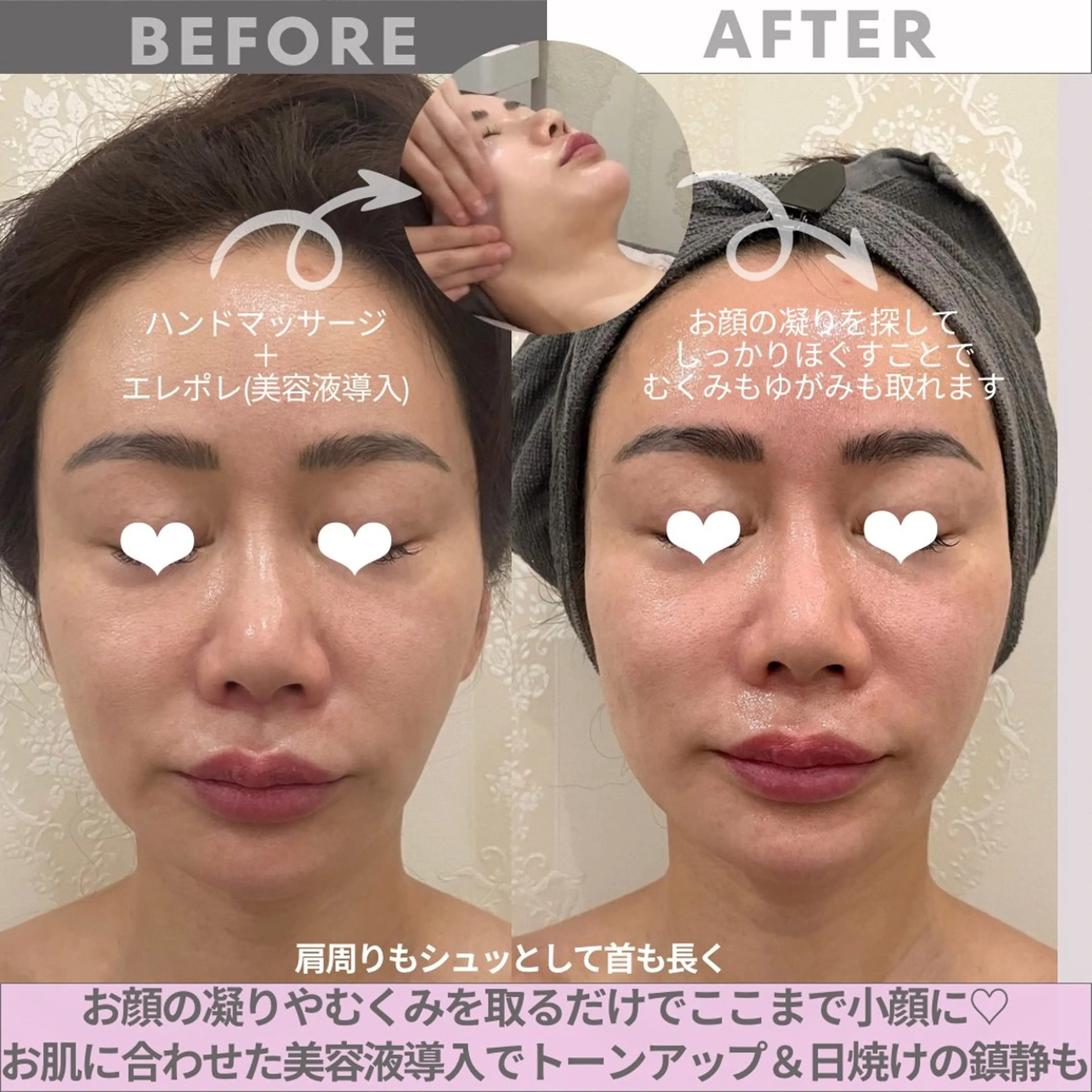 エステ リンデザ 山口のエステ・リラクイメージ