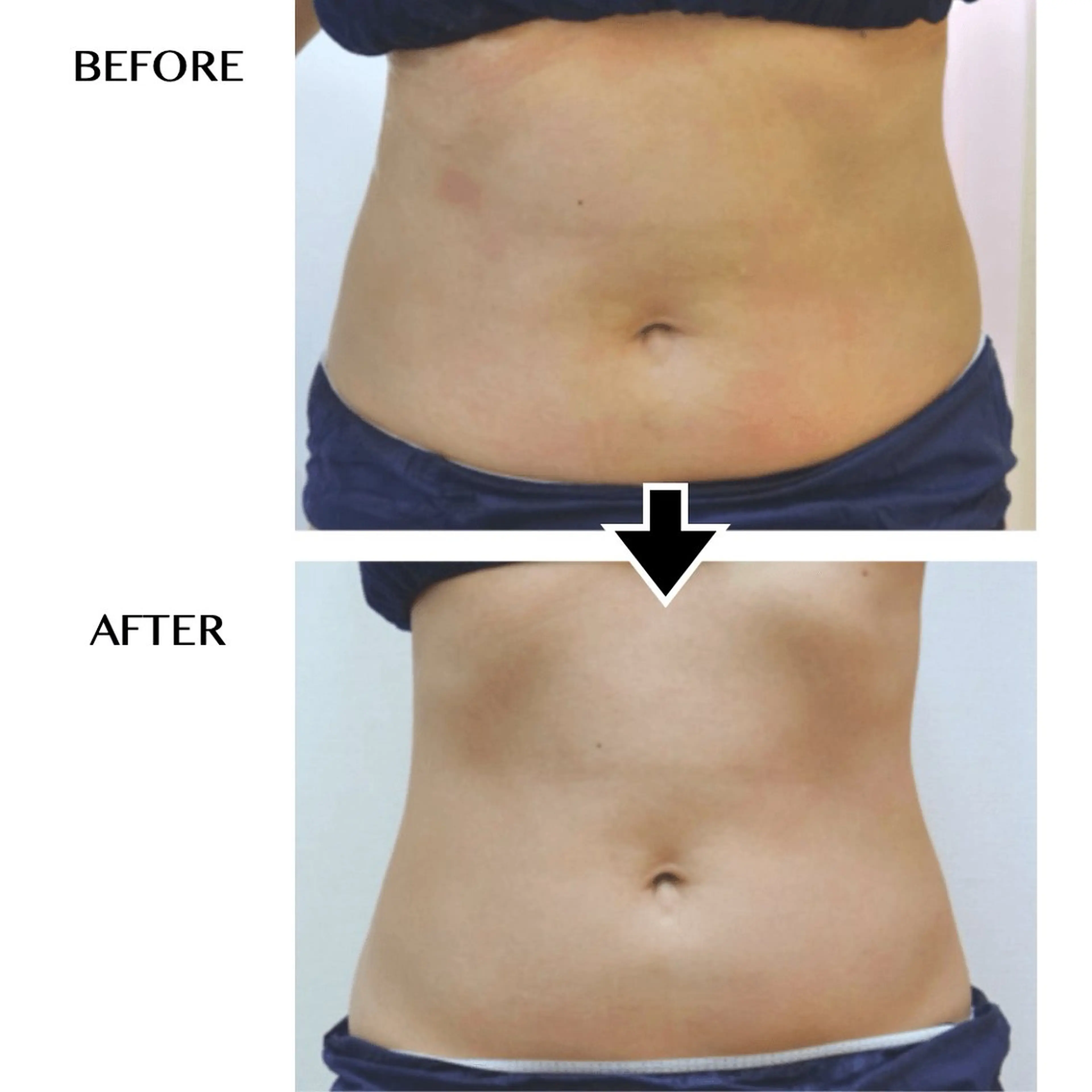 バストアップ・痩身 脱毛/🌺ｺｵﾘﾅのエステ・リラクイメージ