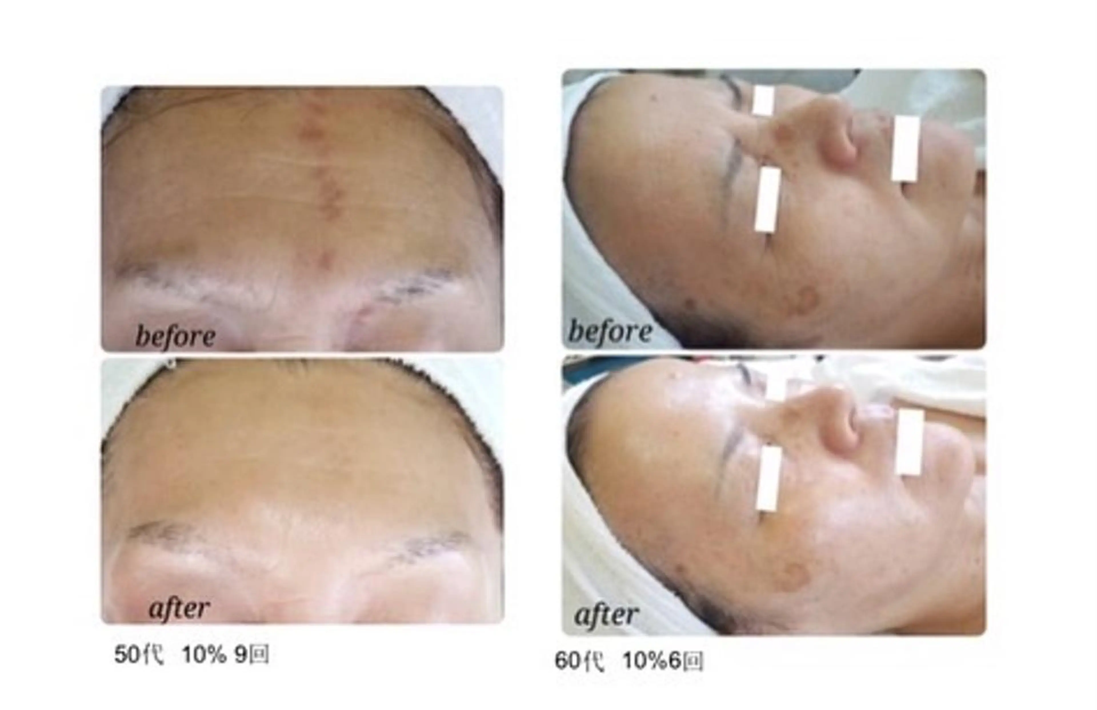 noel de mi 前川亜里沙のエステ・リラクイメージ