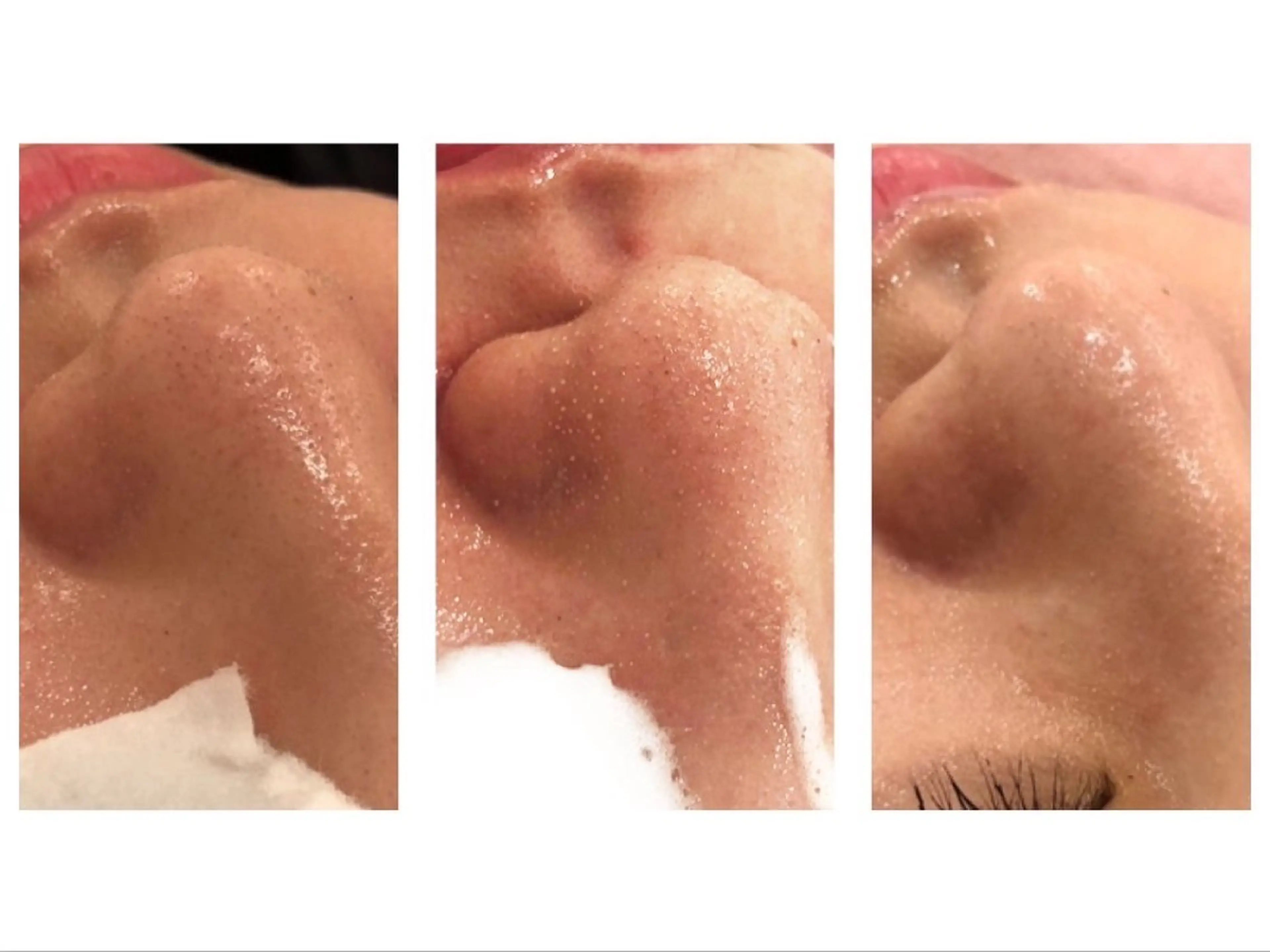 痛くない美肌脱毛 AZALEA本厚木店のエステ・リラクイメージ