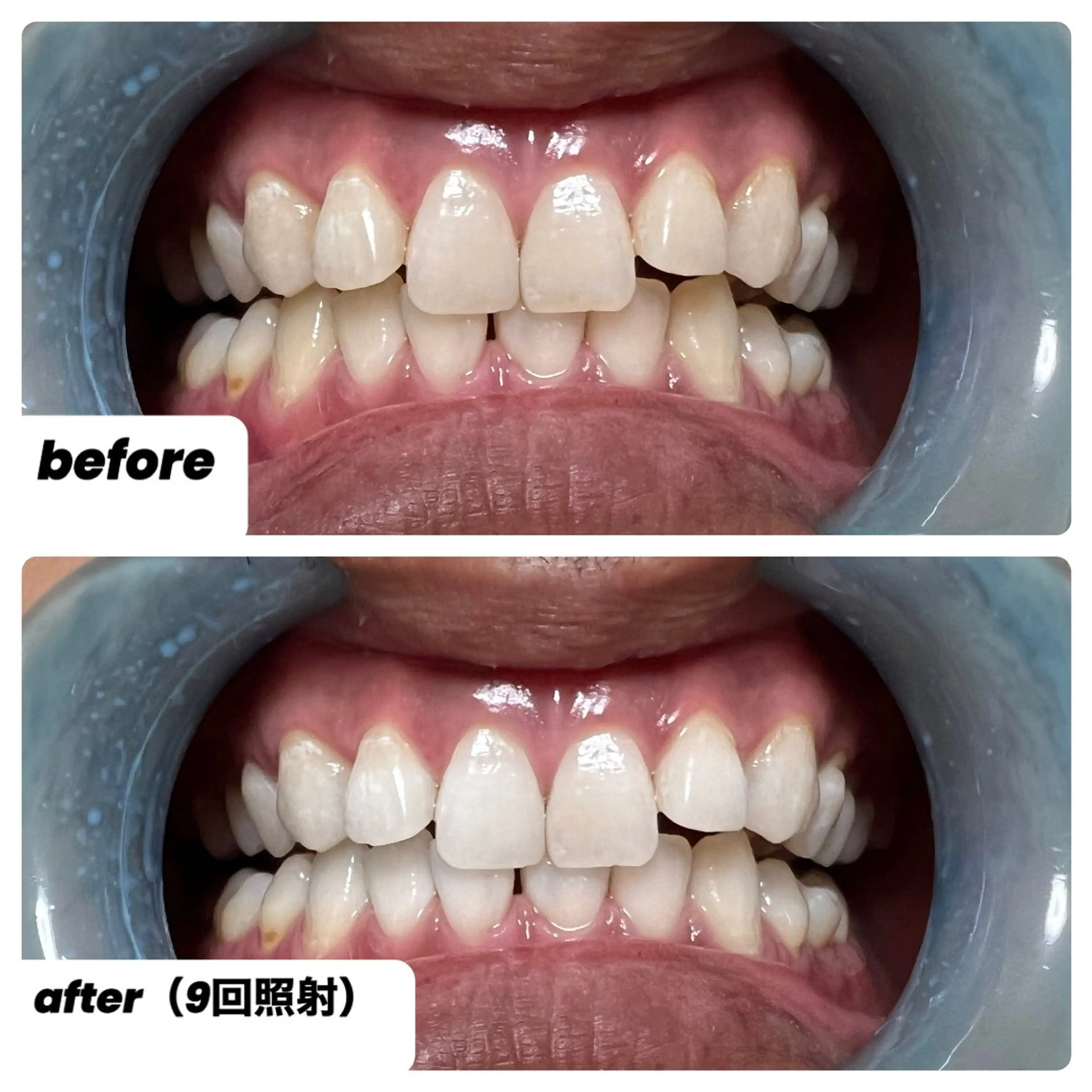 Akala miのエステ・リラクイメージ