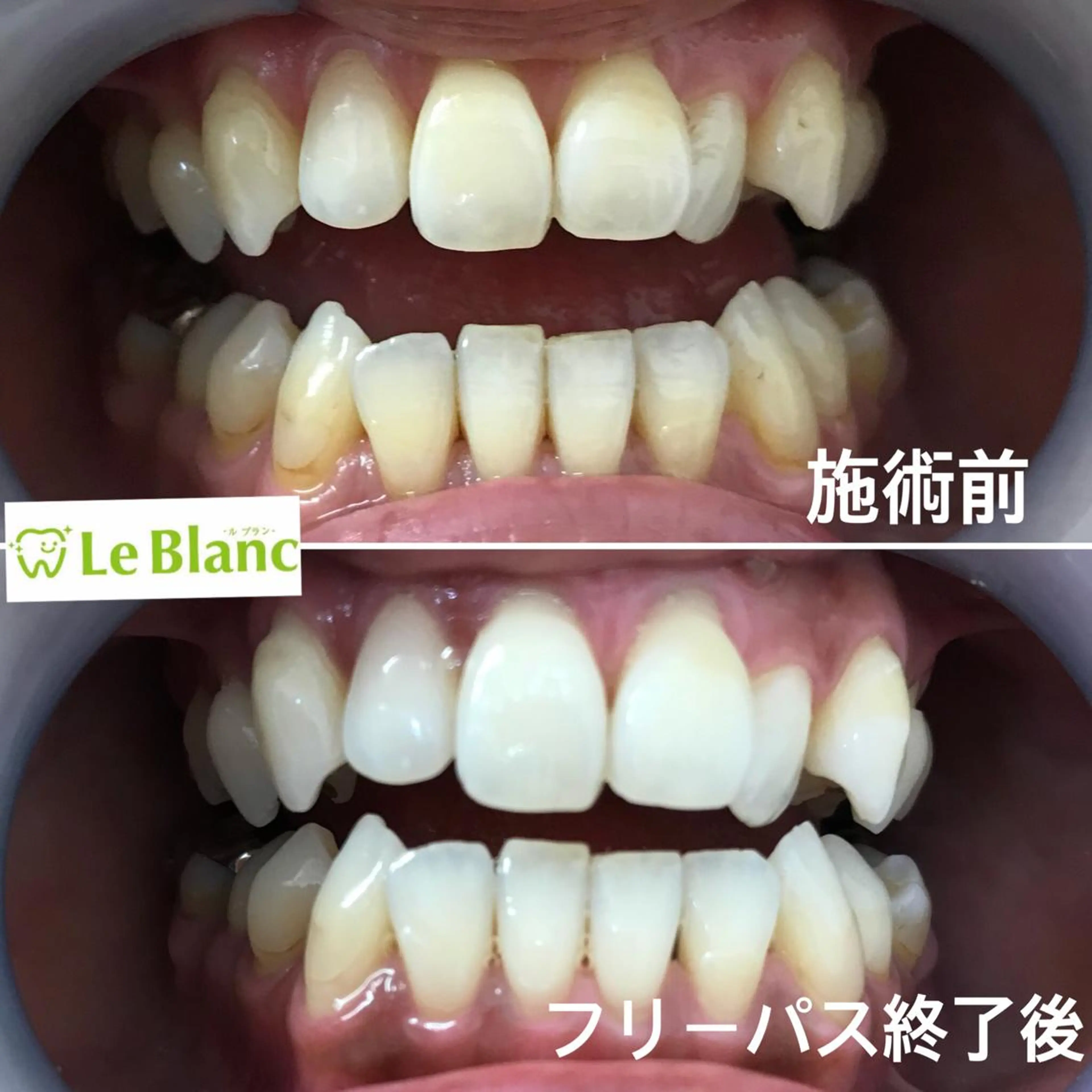 その他 Le Blanc  奈良店のその他イメージ