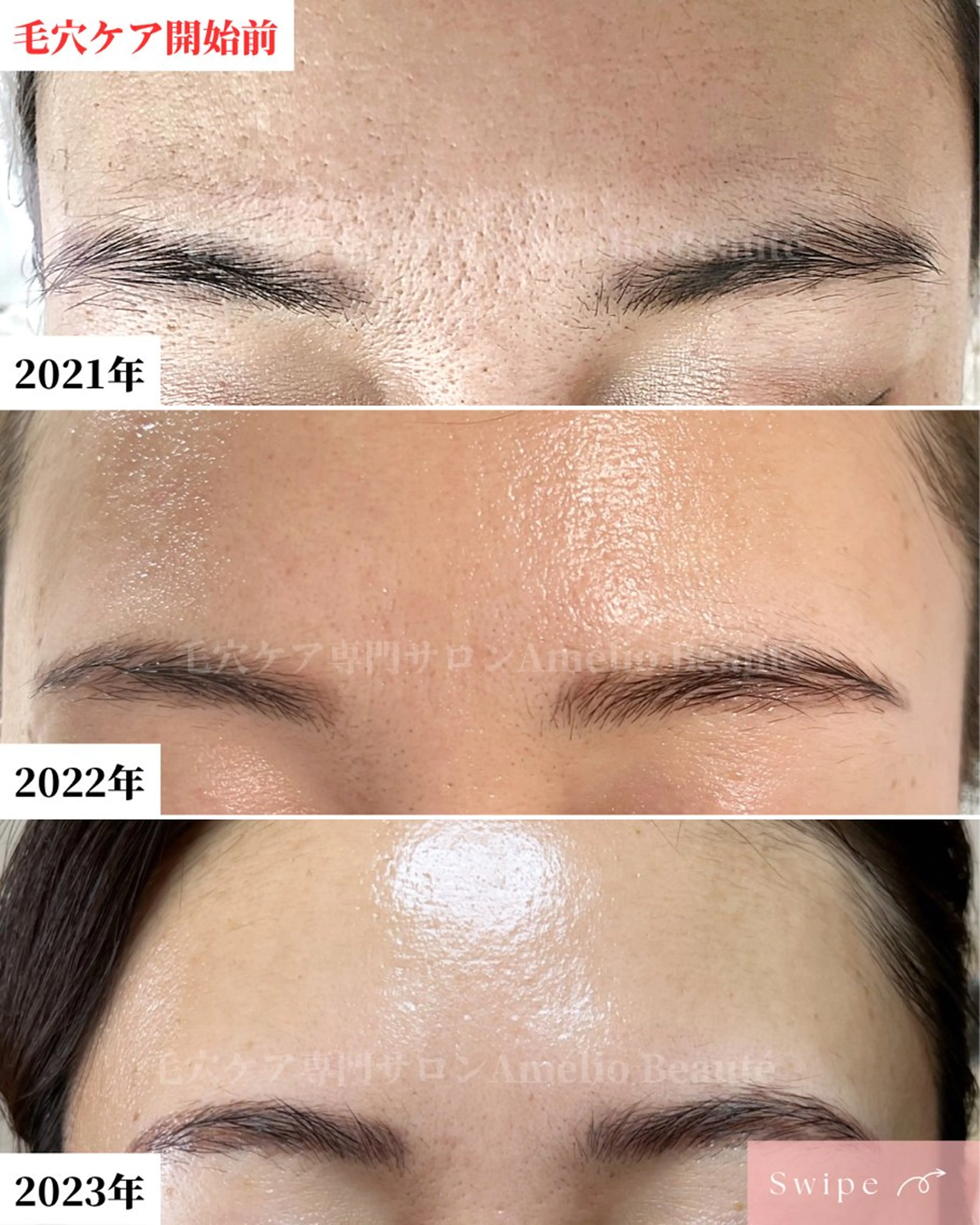 毛穴ケア専門サロン アメリオボーテのその他イメージ